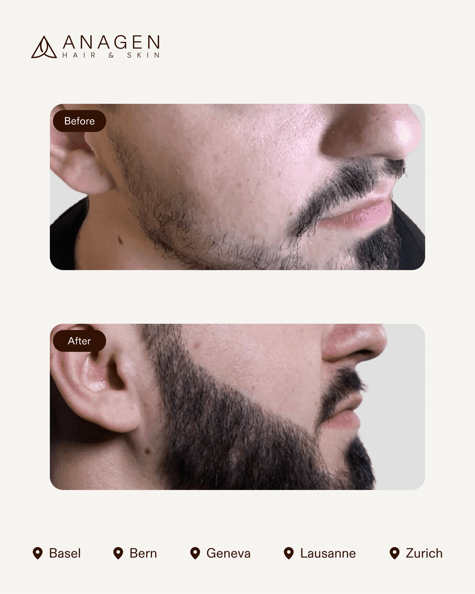 Anagen Clinic results