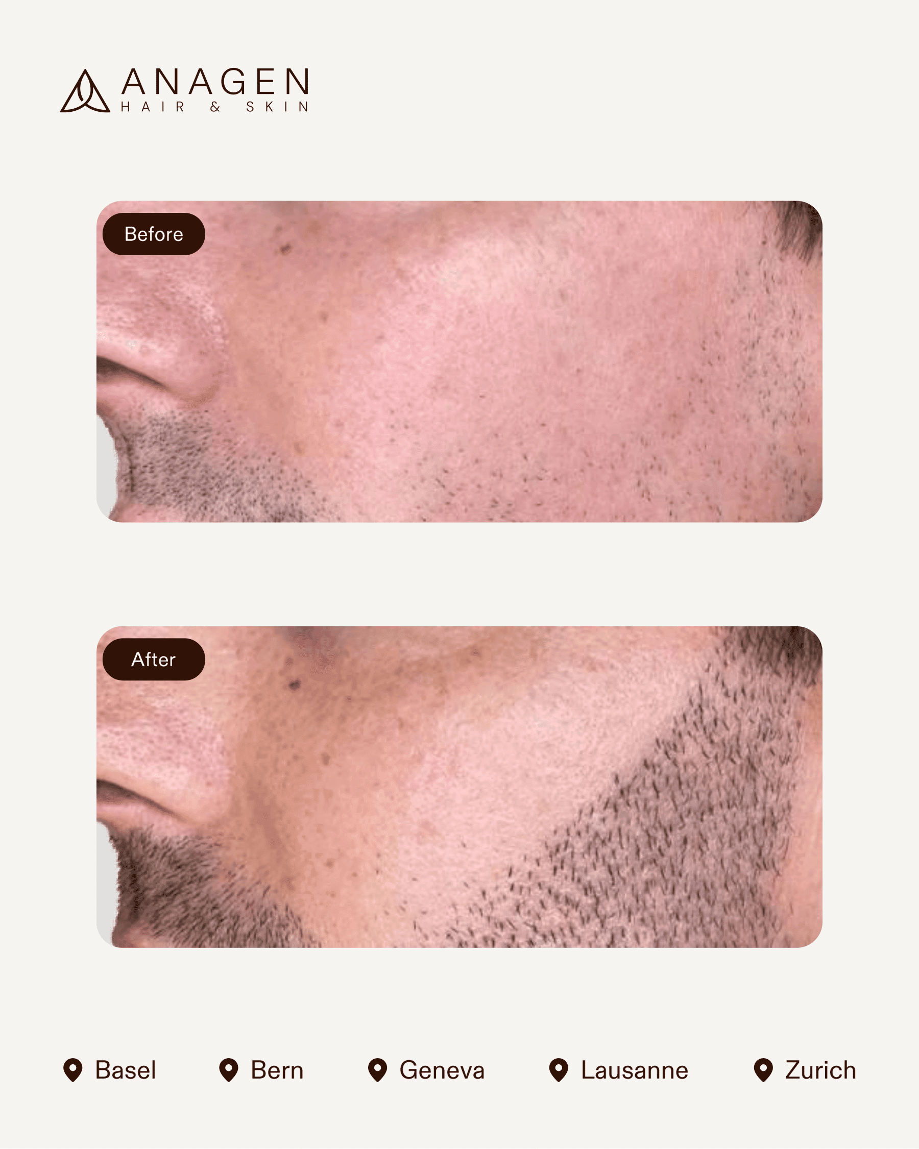 Anagen Clinic results