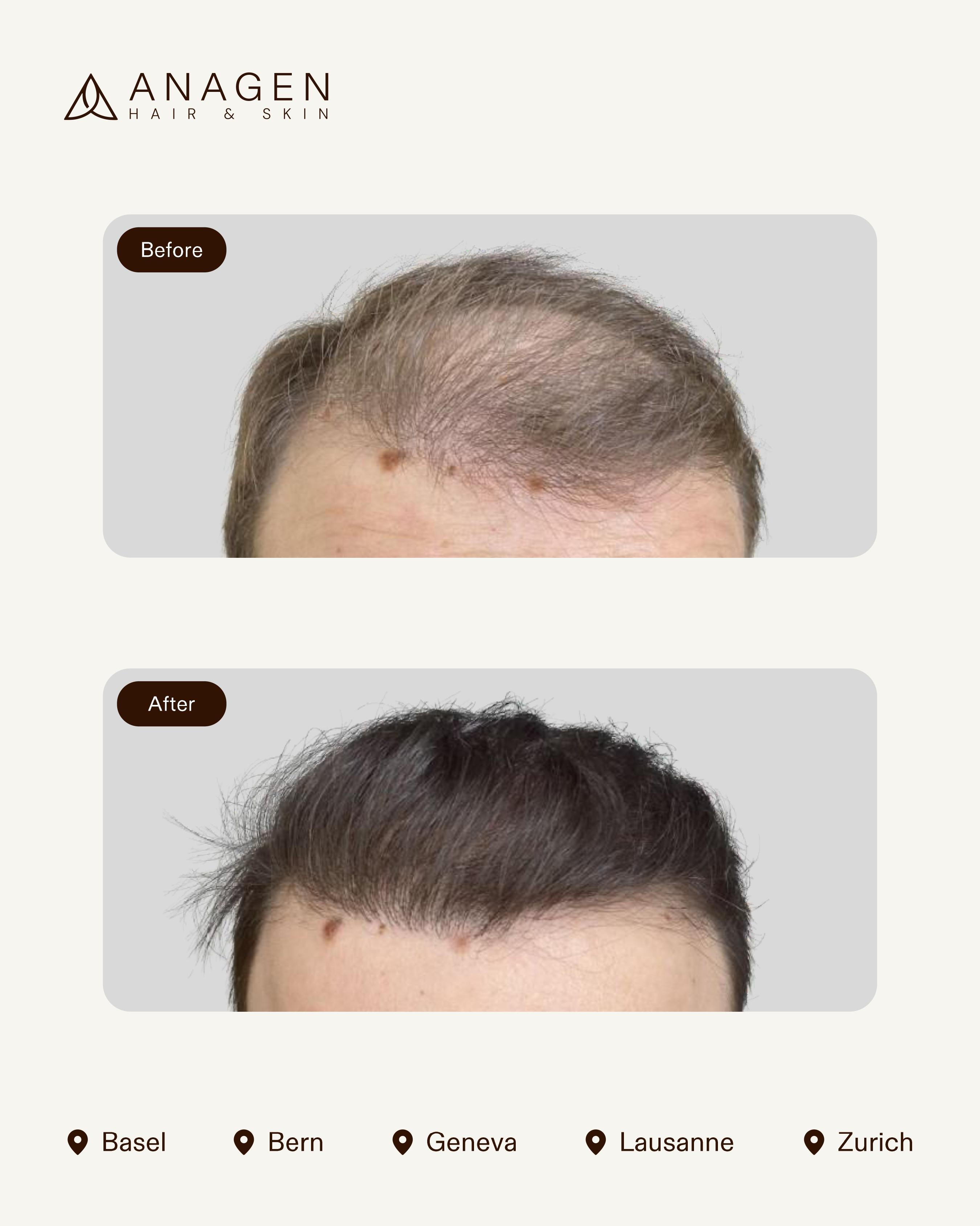 Anagen Clinic results