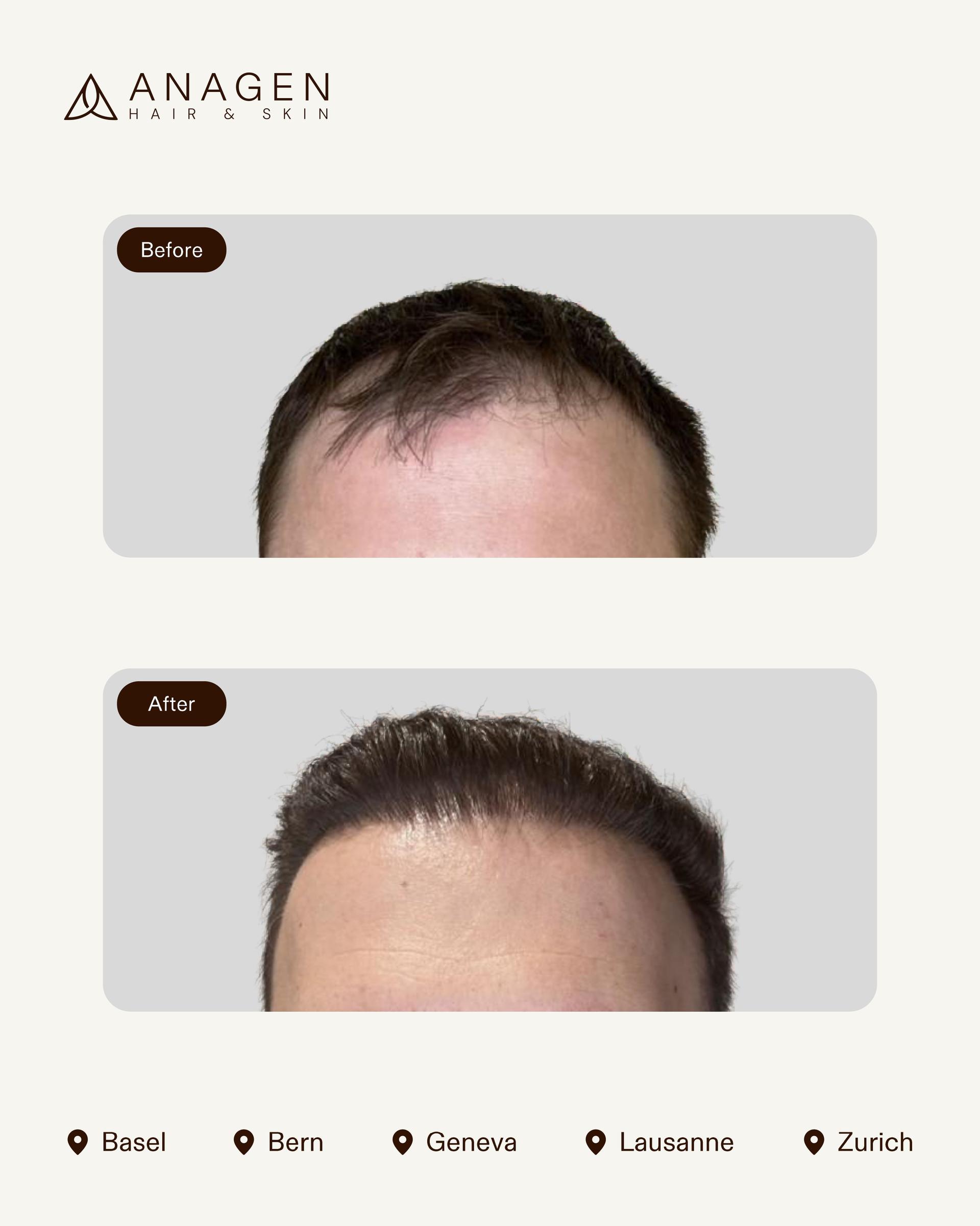 Anagen Clinic results