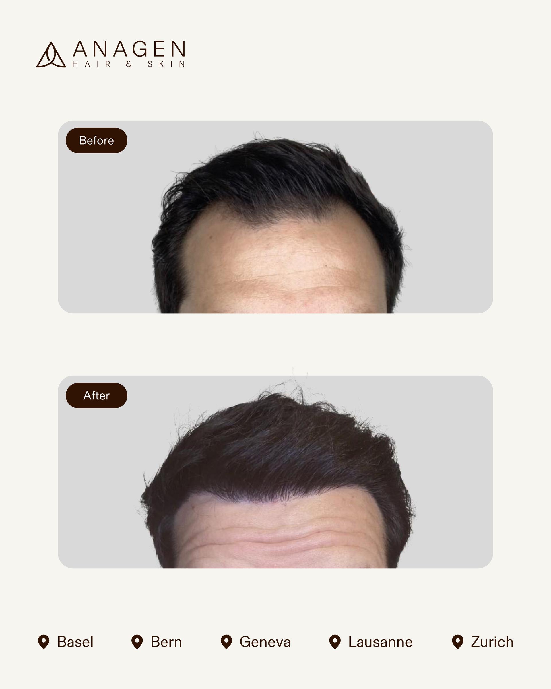 Before-After HT_page-0007