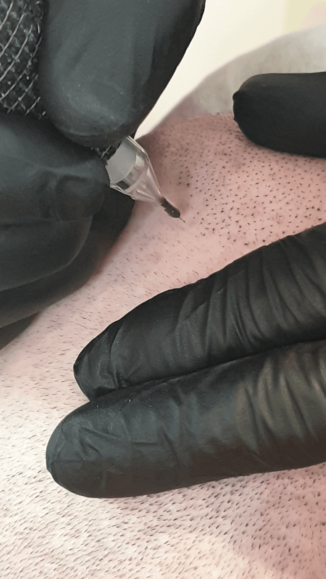 Scalp Micro Pigmentation result