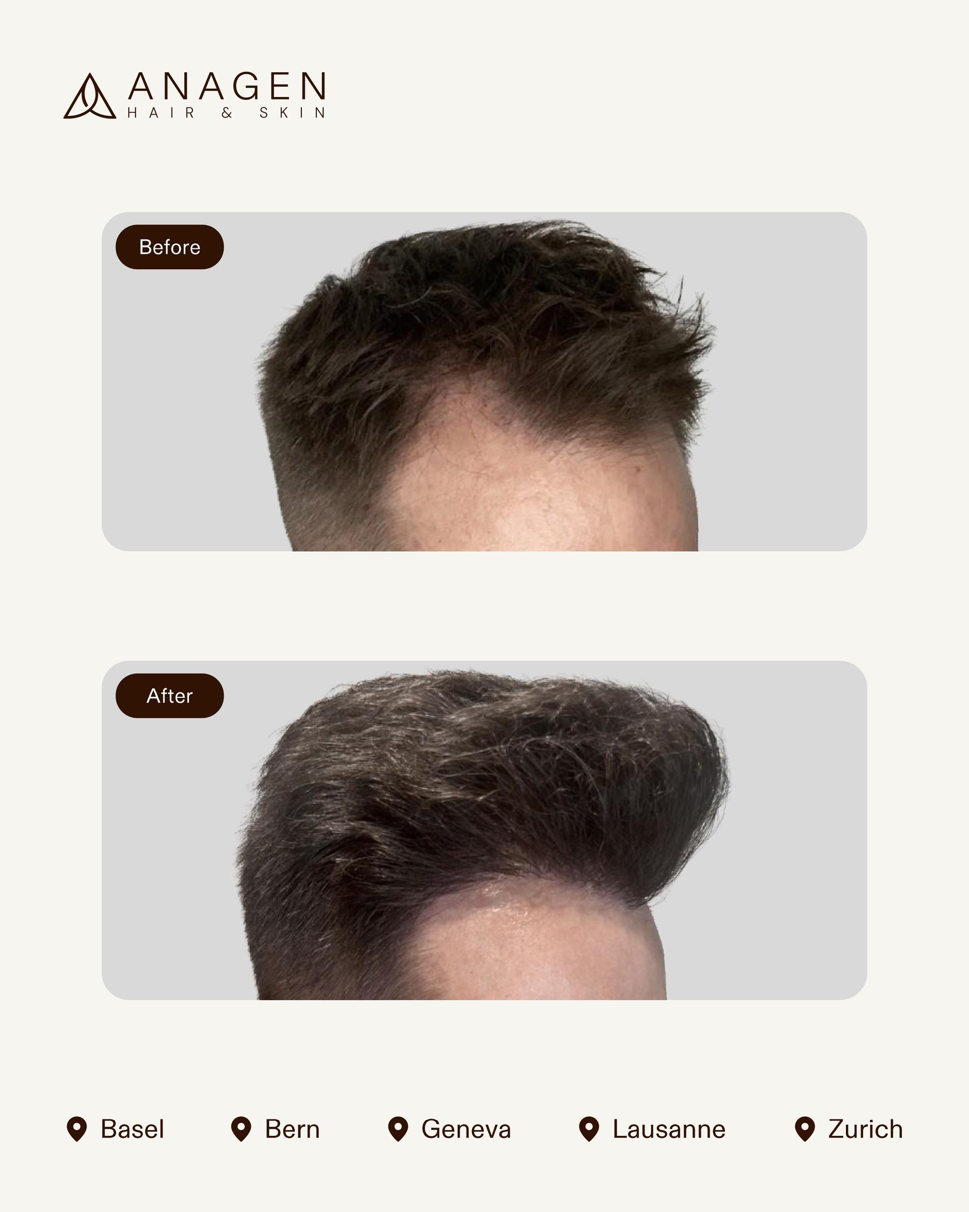 Before-After HT_page-0009