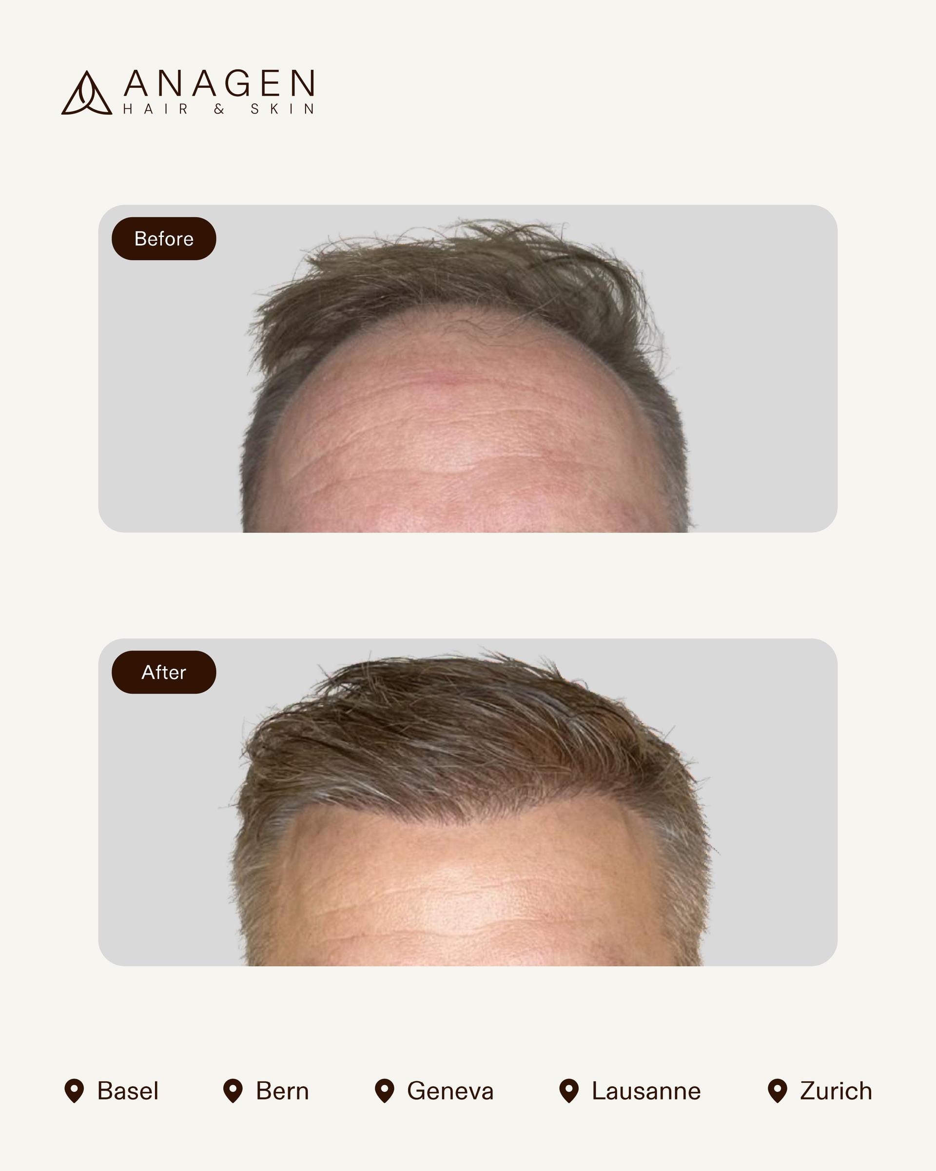 Before-After HT_page-0010