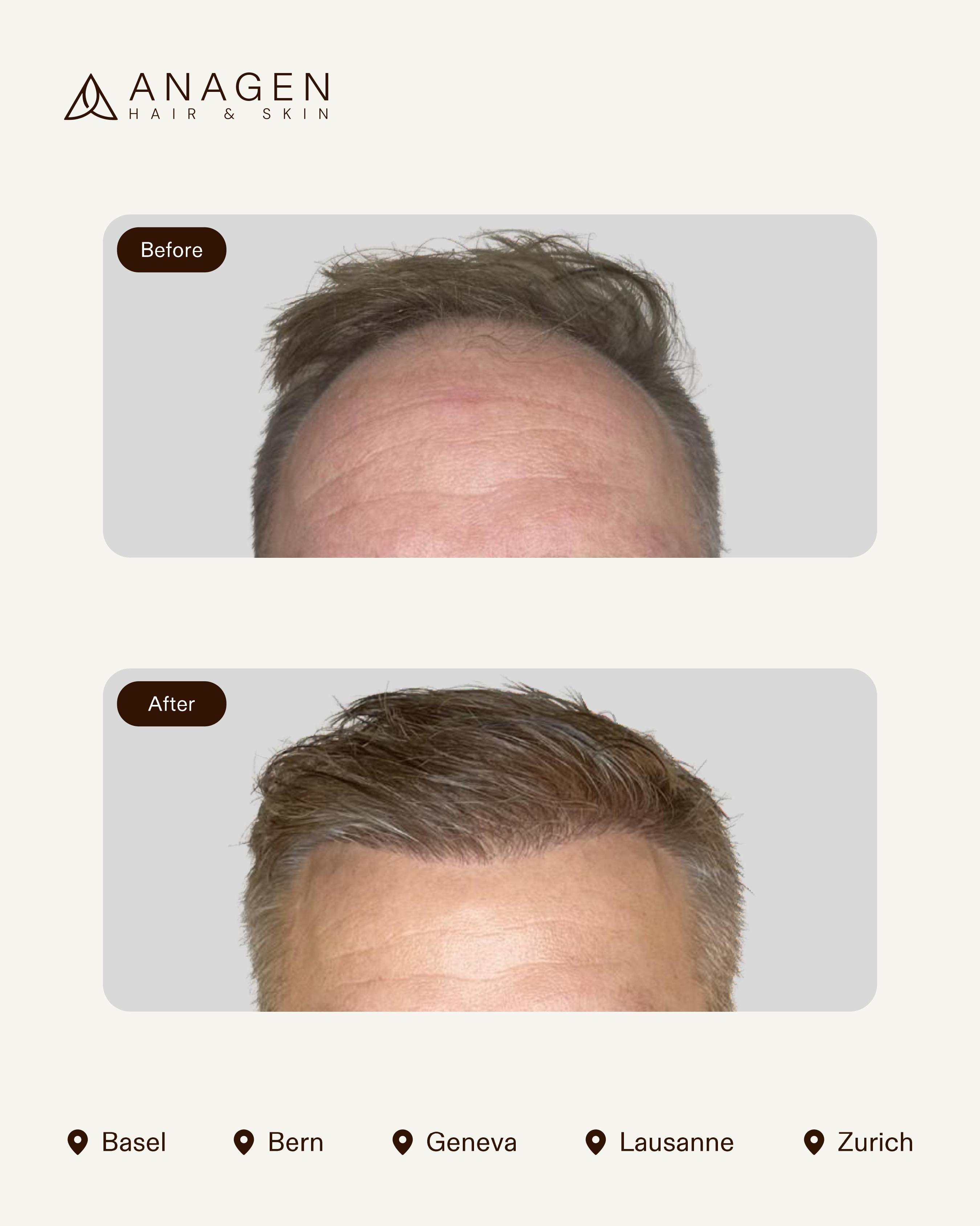 Before-After HT_page-0010