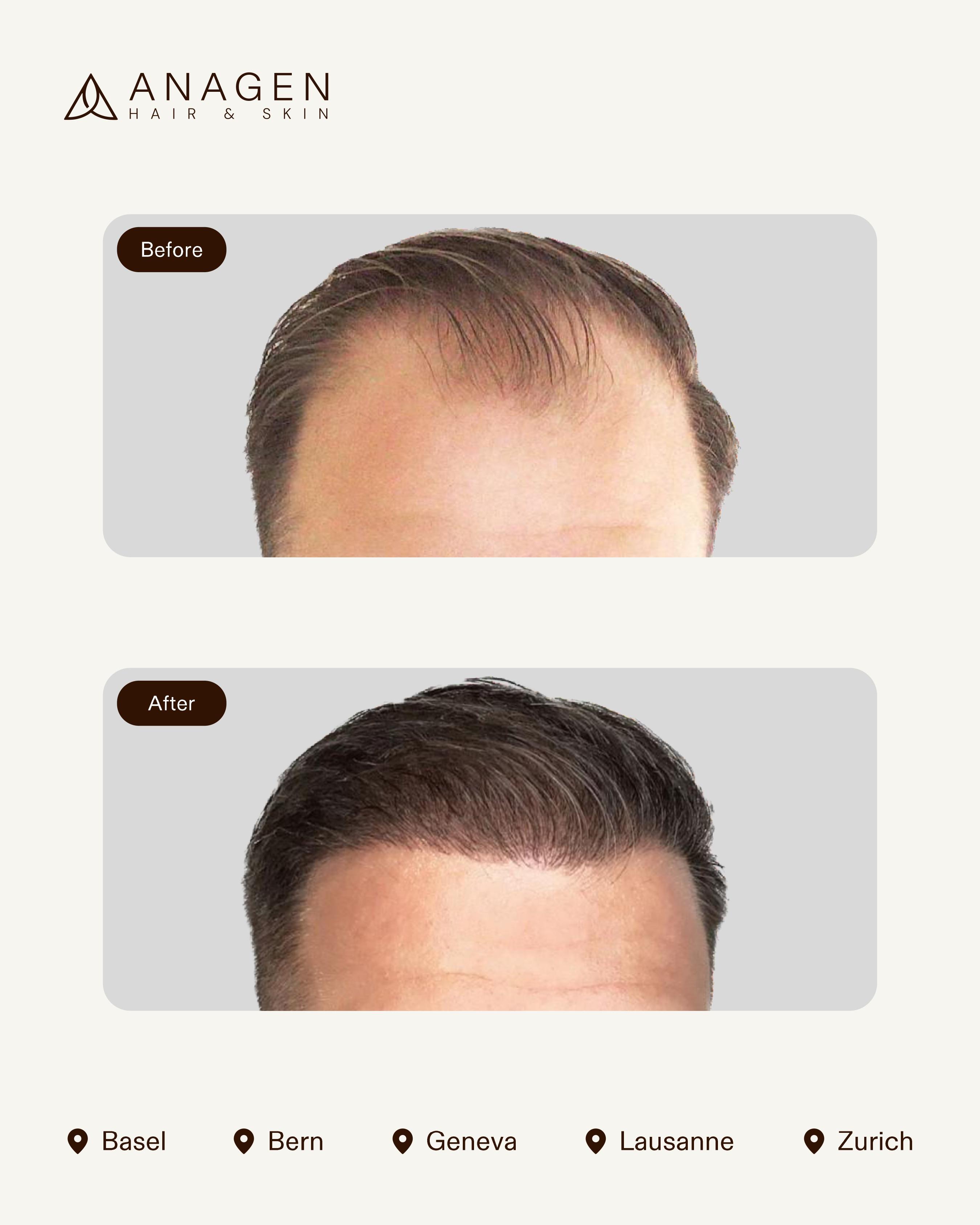 Before-After HT_page-0011