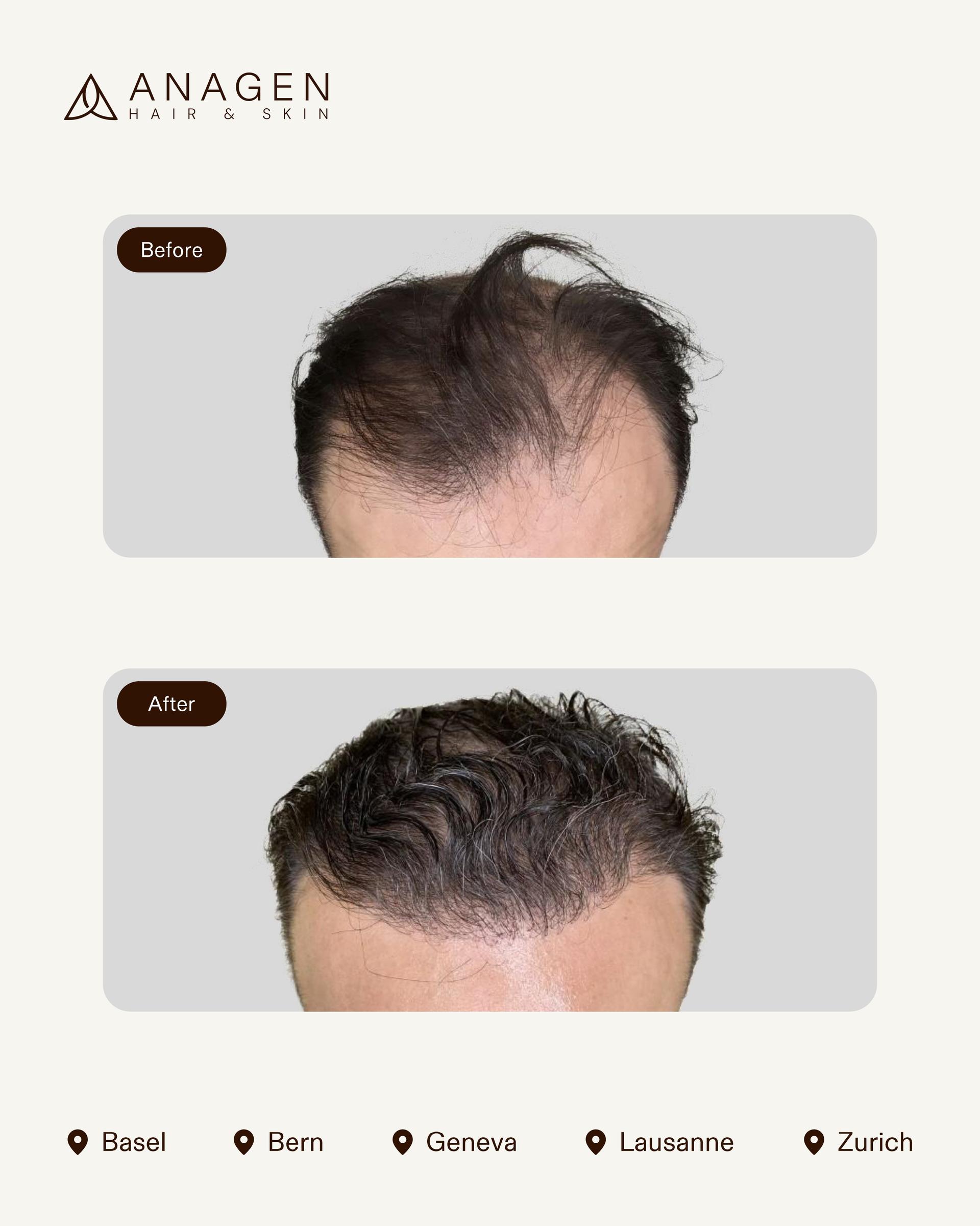 Before-After HT_page-0012