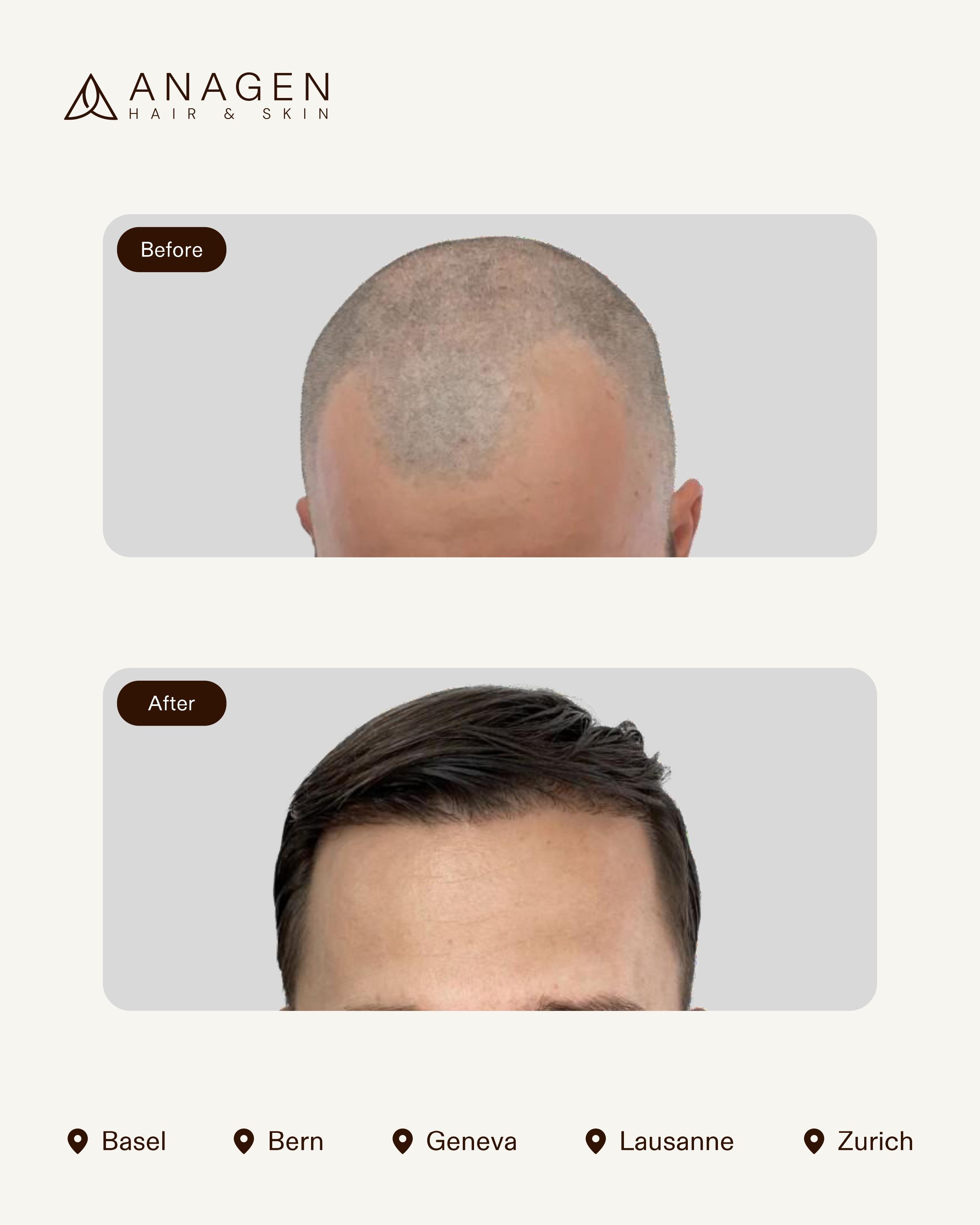 Before-After HT_page-0014