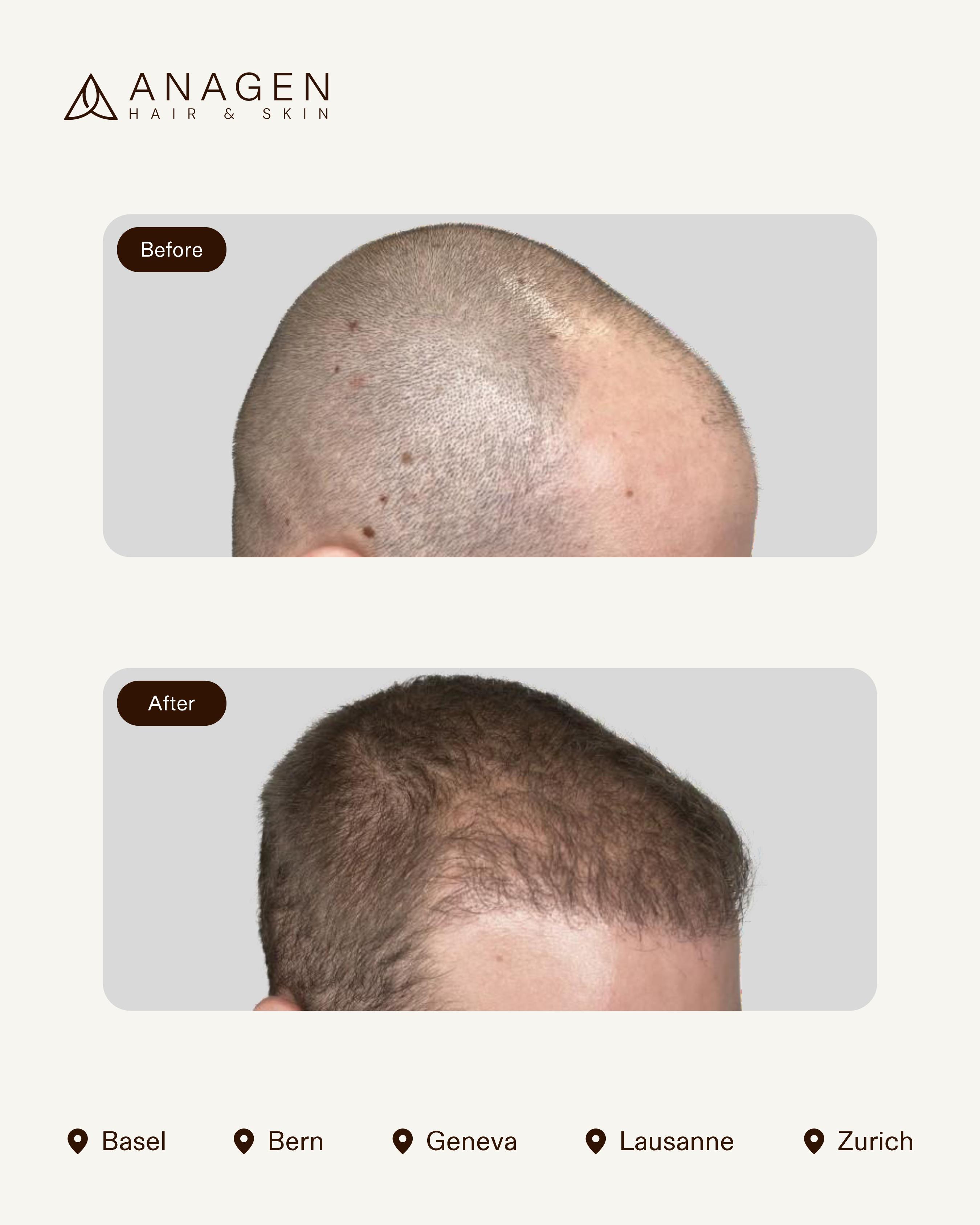 Before-After HT_page-0015