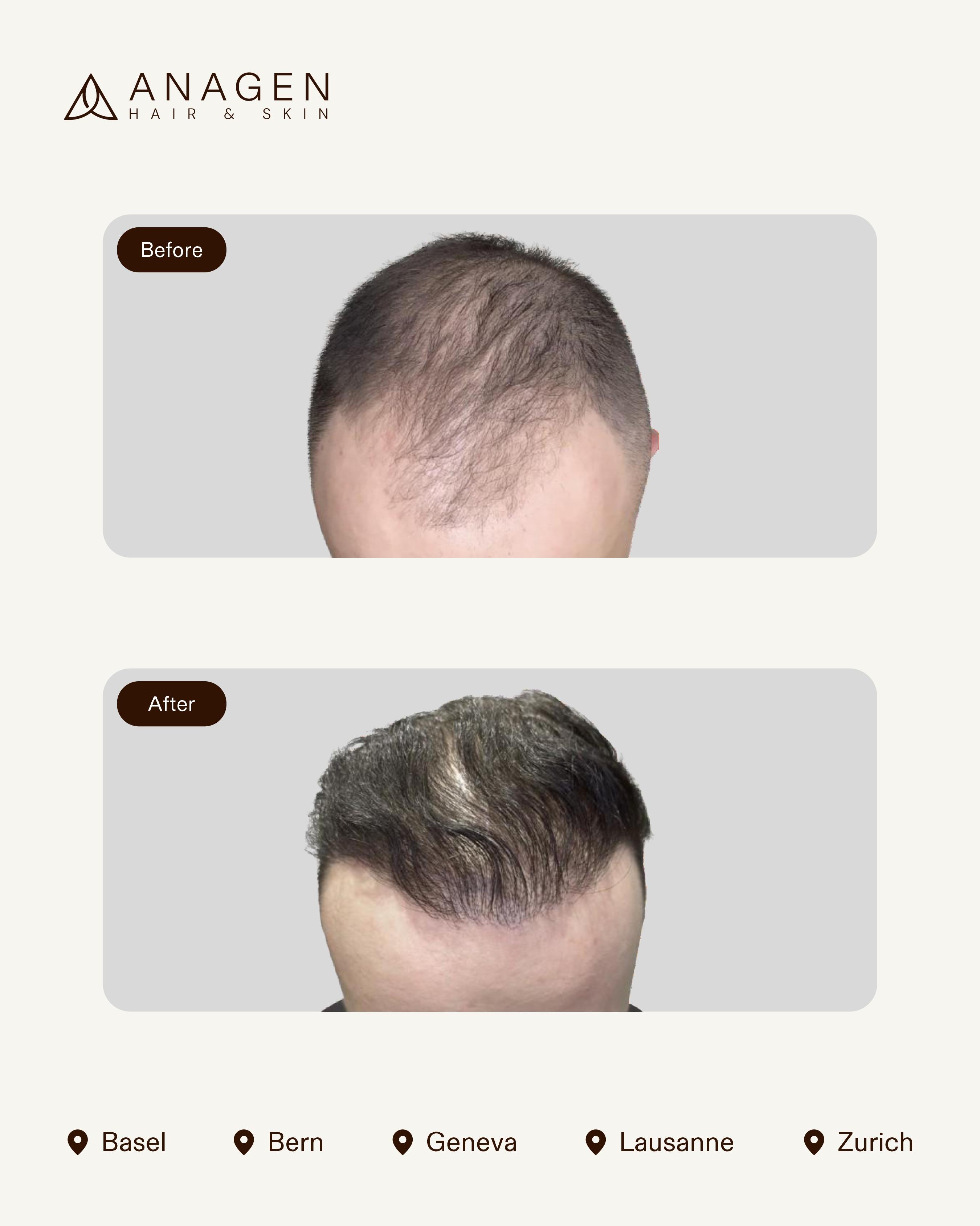 Before-After HT_page-0016