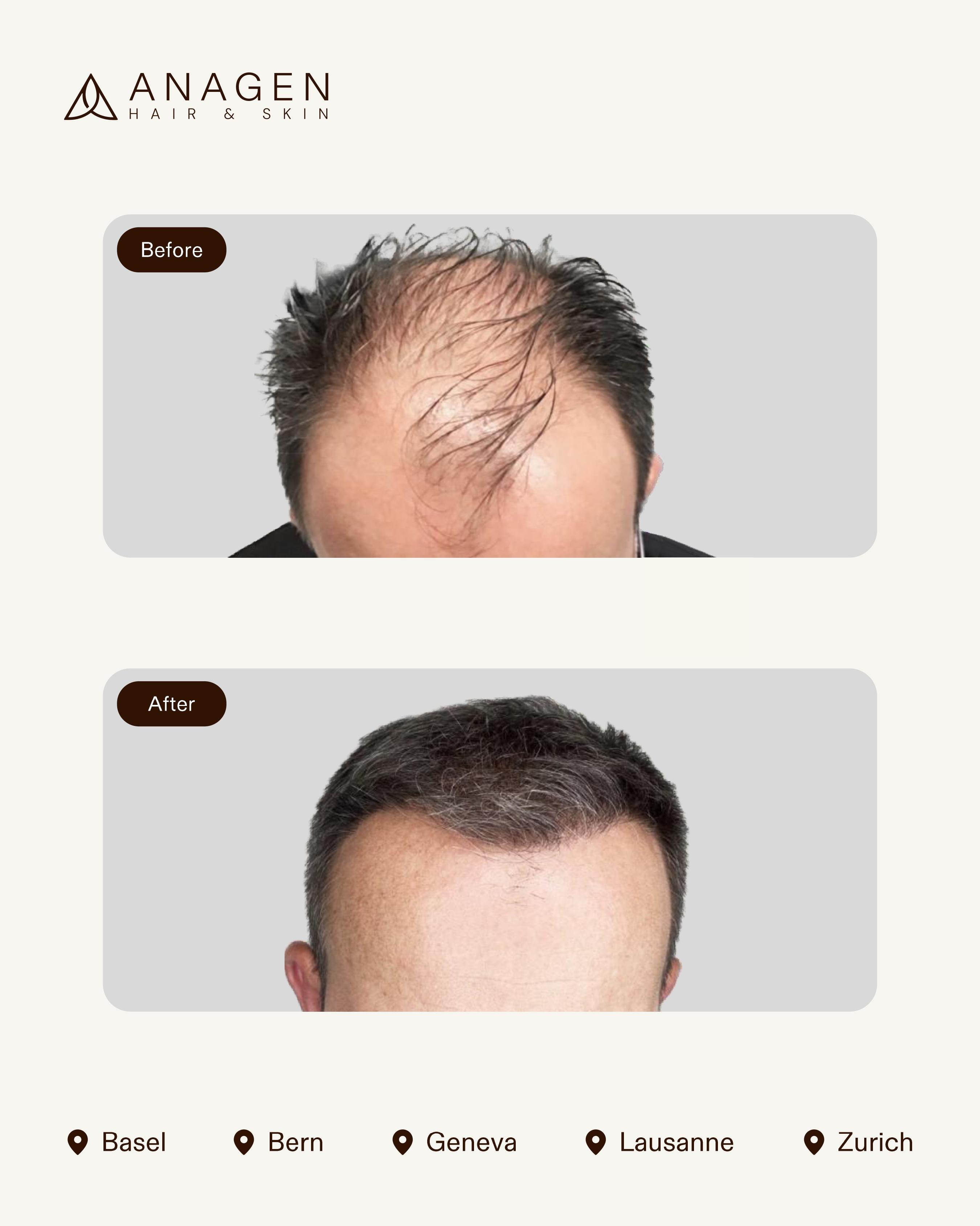 Before-After HT_page-0017