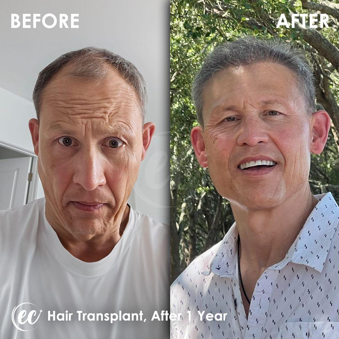 estherian Hair Surgery 7