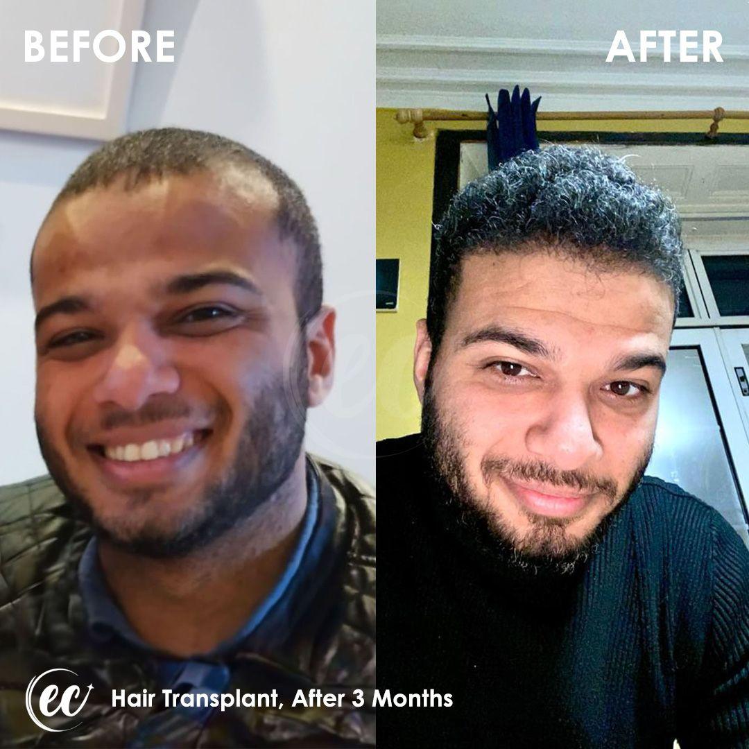 estherian Hair Surgery 7