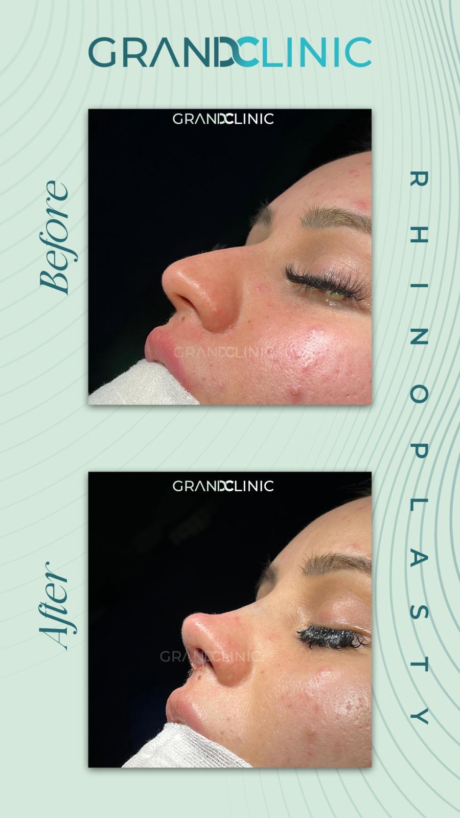 e41ec5c5-8adc-45ce-8fa8-fc02aea3985e