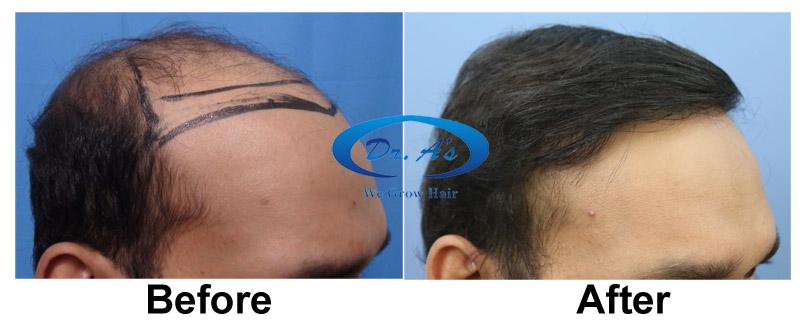 A comparison picture 305_07