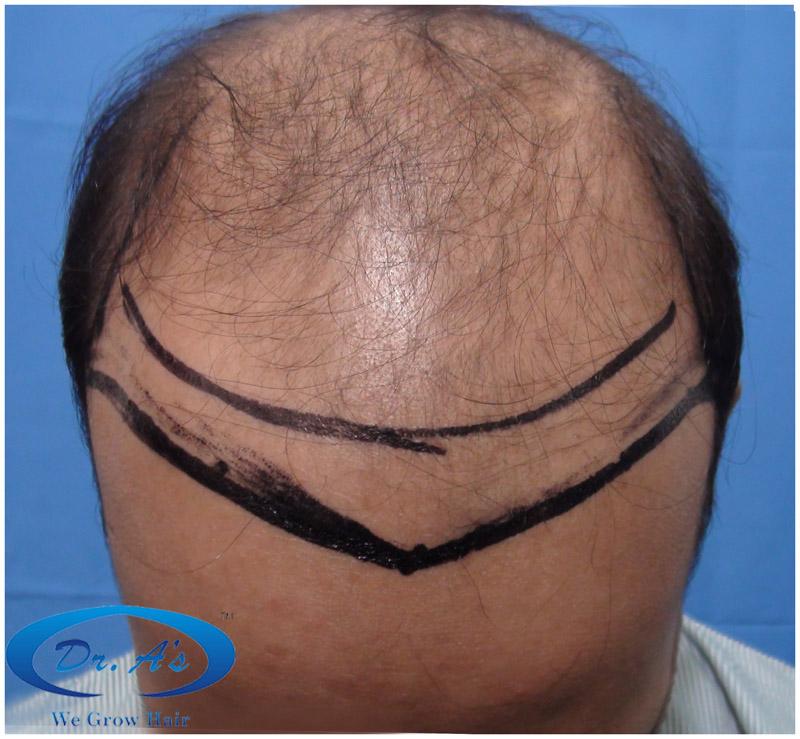 Before picture 508_29