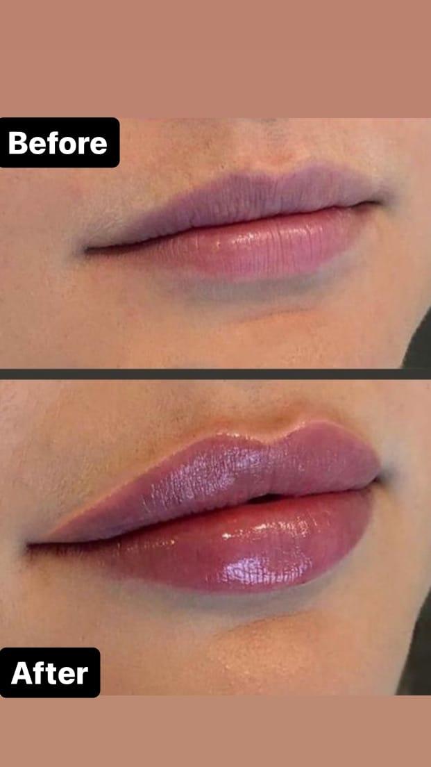lips
