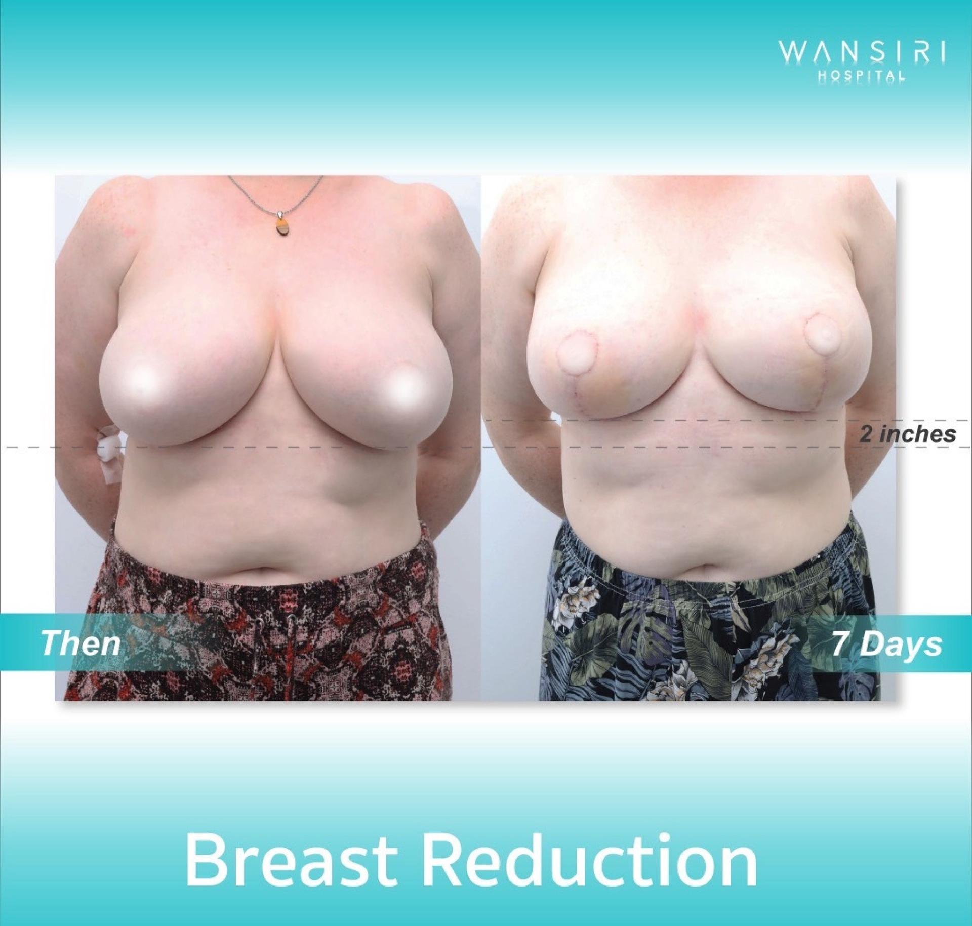 20250122_085414811_iOS