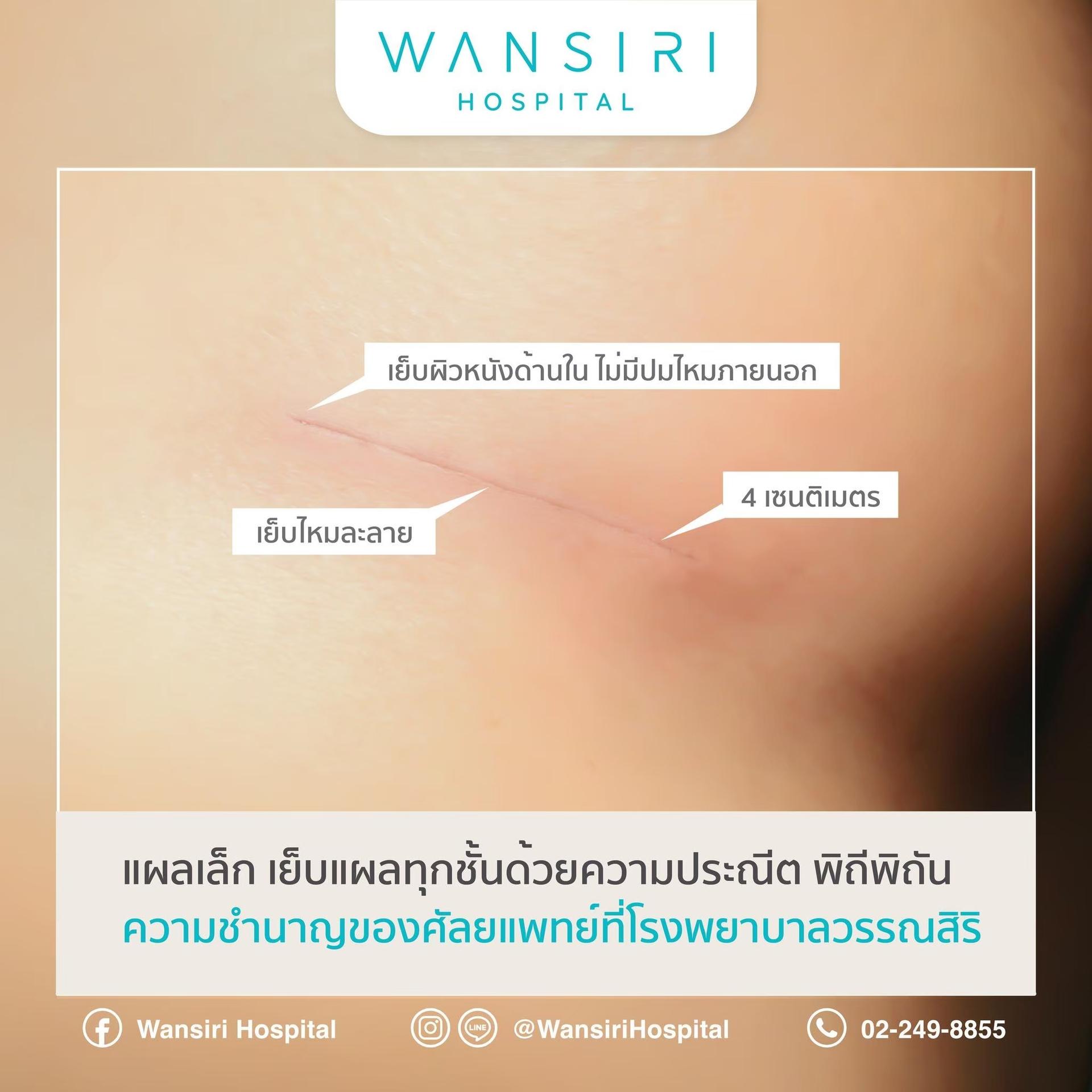 Wansiri breast augmentation