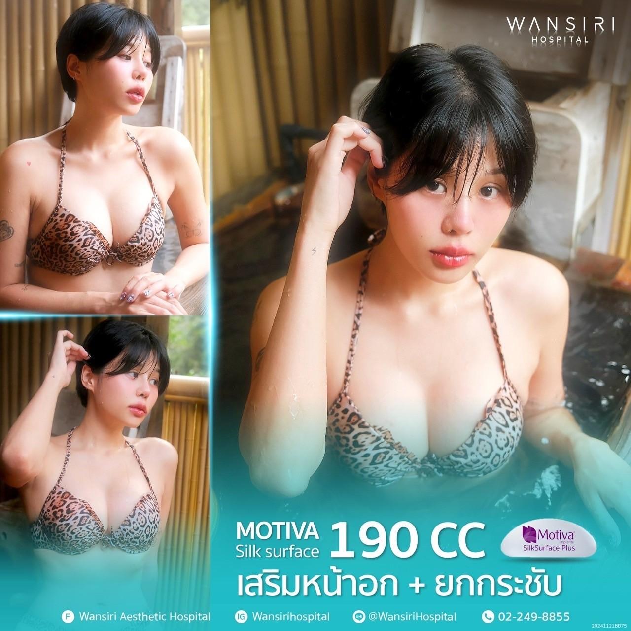 Wansiri breast augmentation