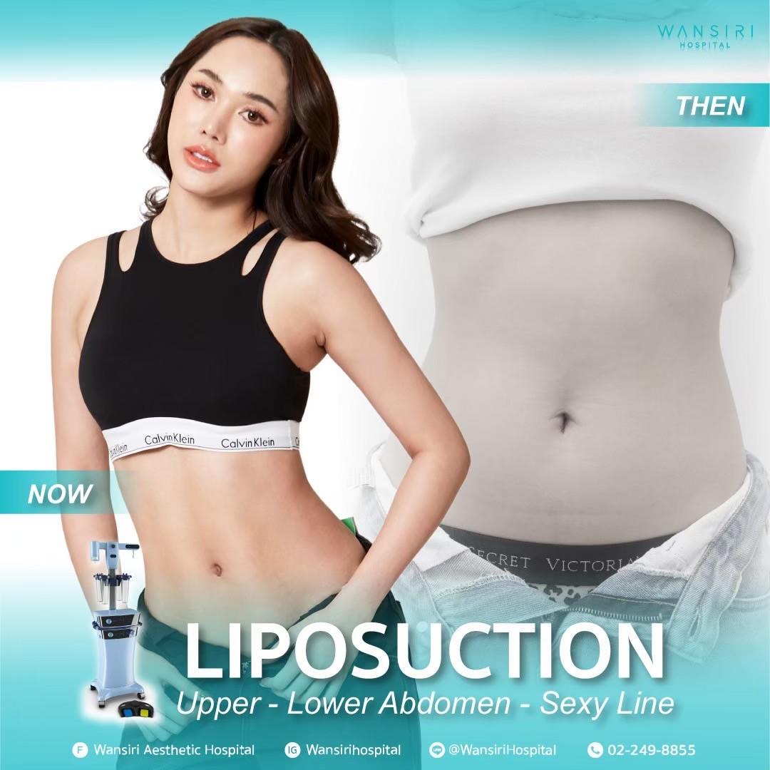 Wansiri Hospital Bangkok Liposuccion