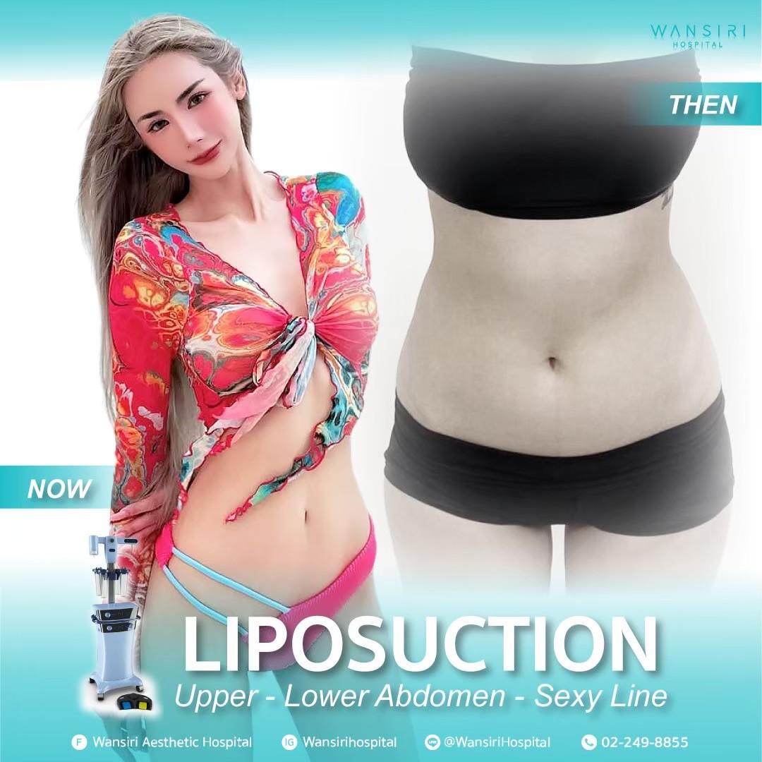 Wansiri Hospital Bangkok Liposuccion