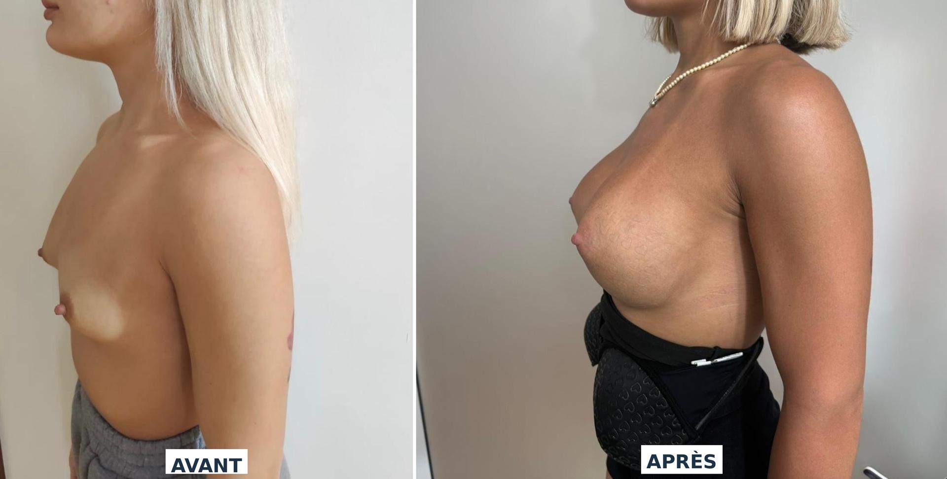 before_after_merged_3