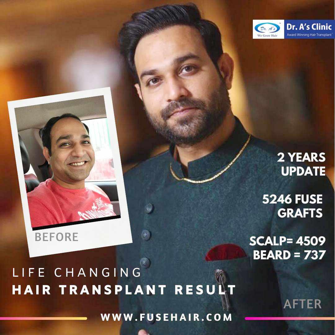 A comparison picture 138_02