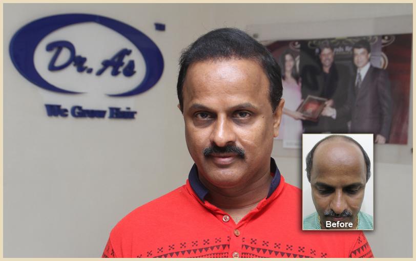 A comparison picture 241_43