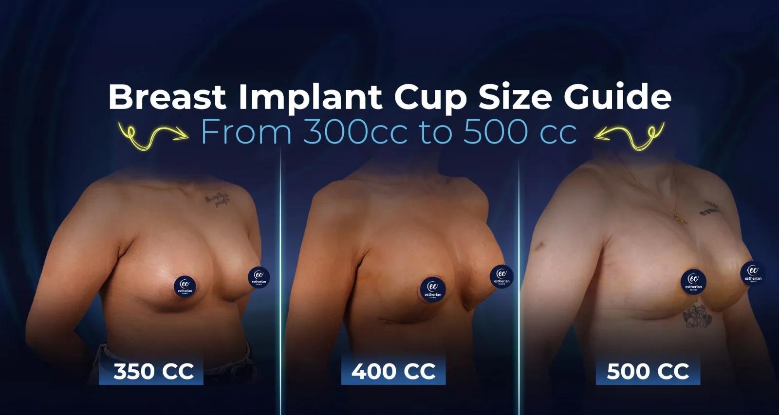 estherian Breast Surgery 10