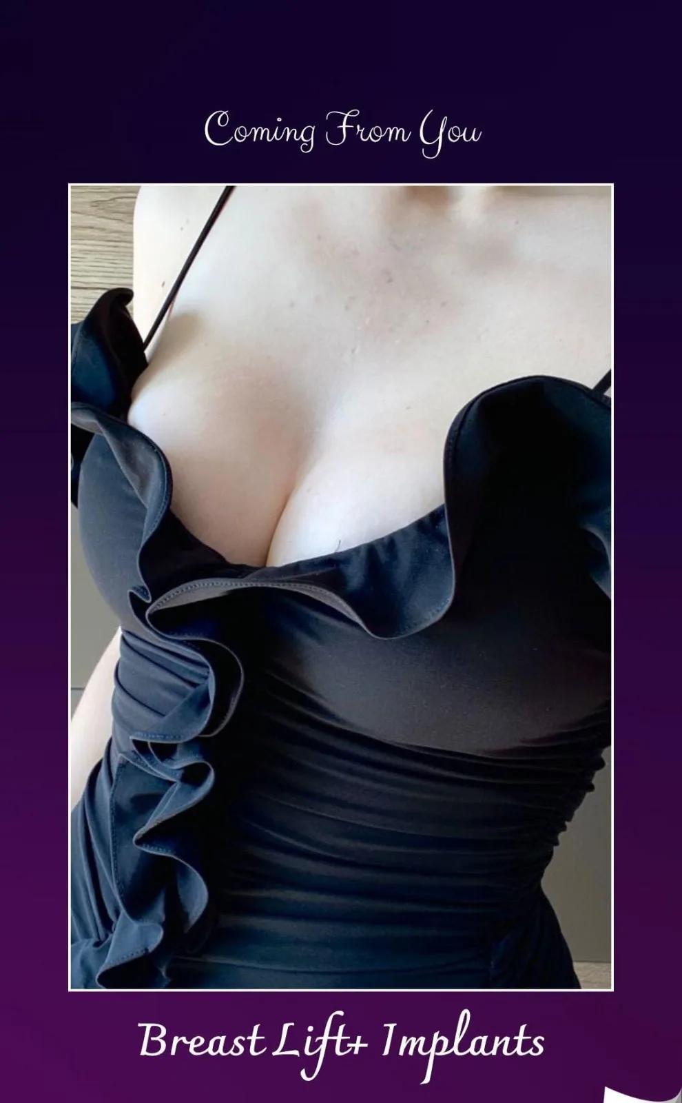 estherian Breast Surgery 10
