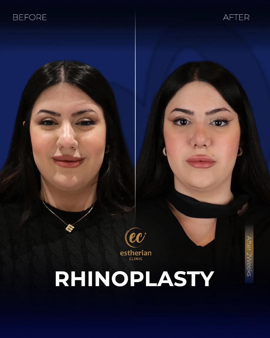 estherian Face Surgery 3