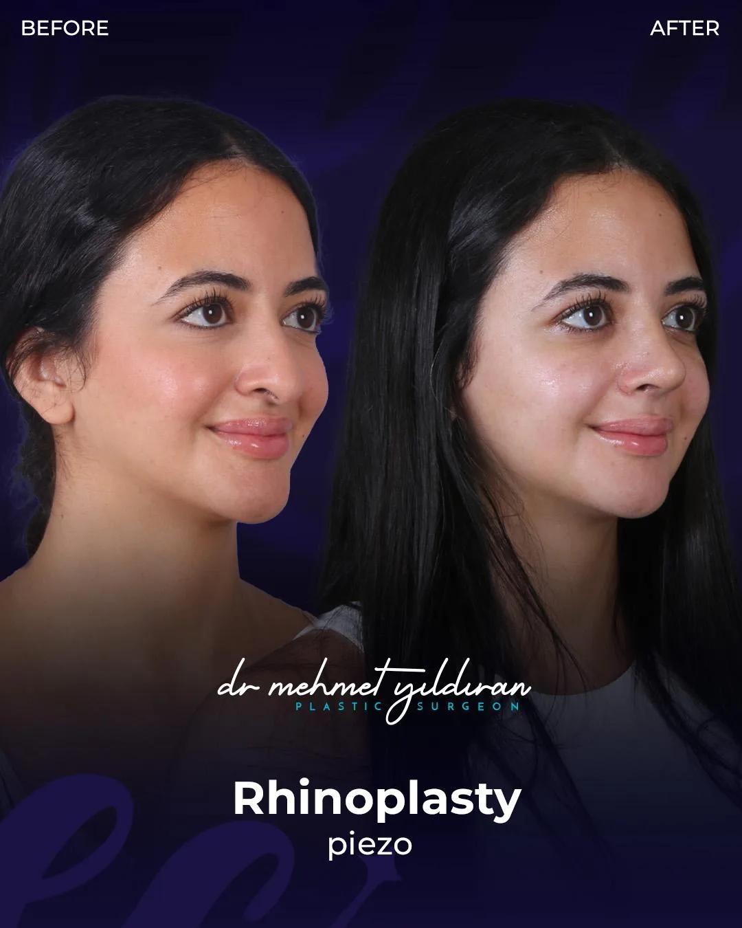 estherian Face Surgery 3