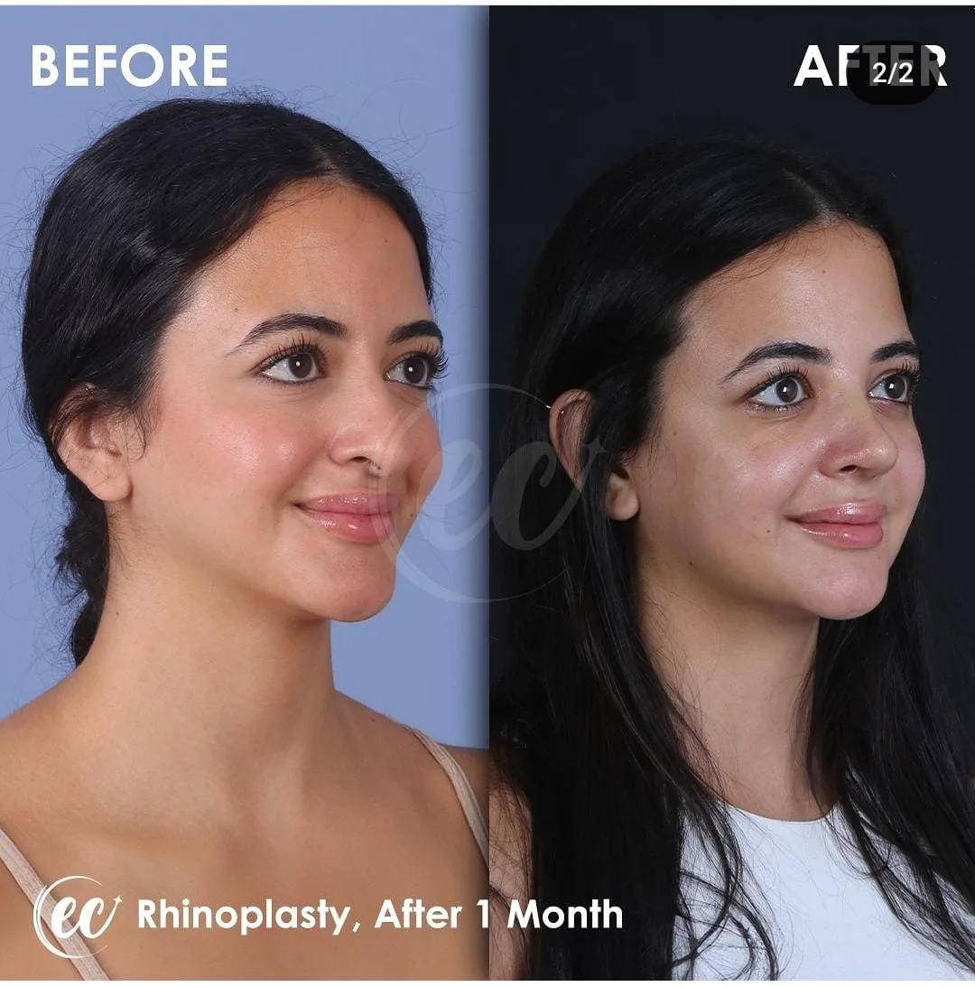 estherian Face Surgery 3
