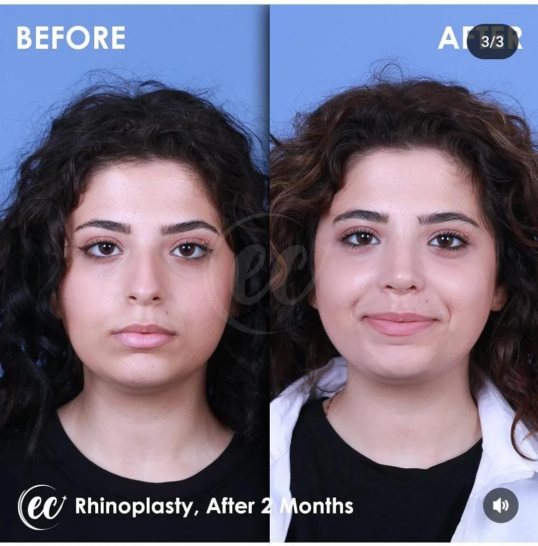 estherian Face Surgery 3
