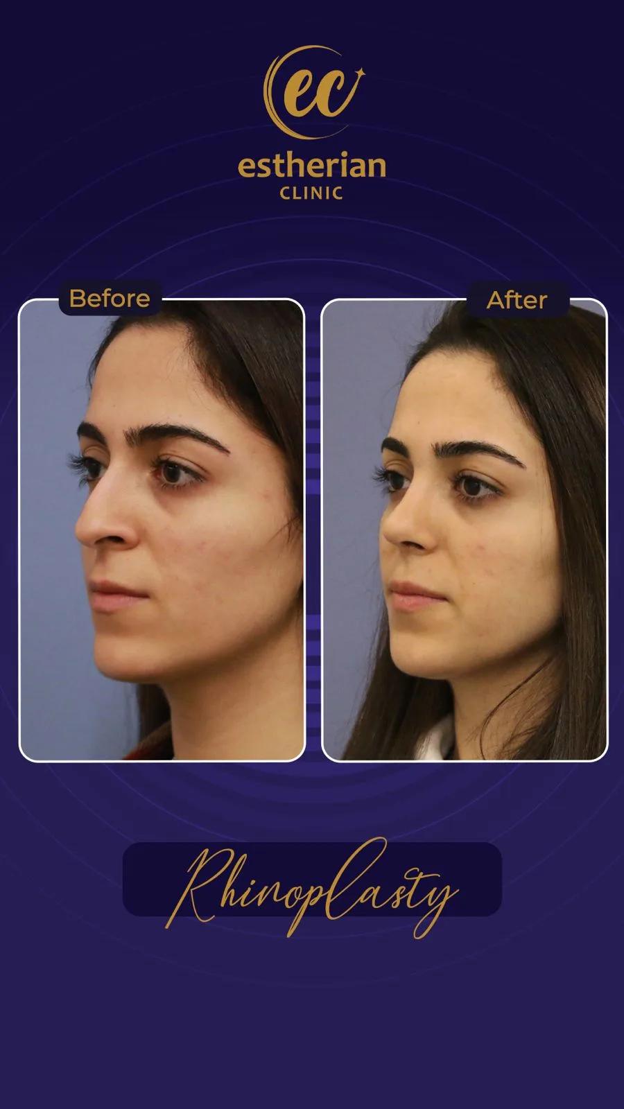 estherian Face Surgery 3