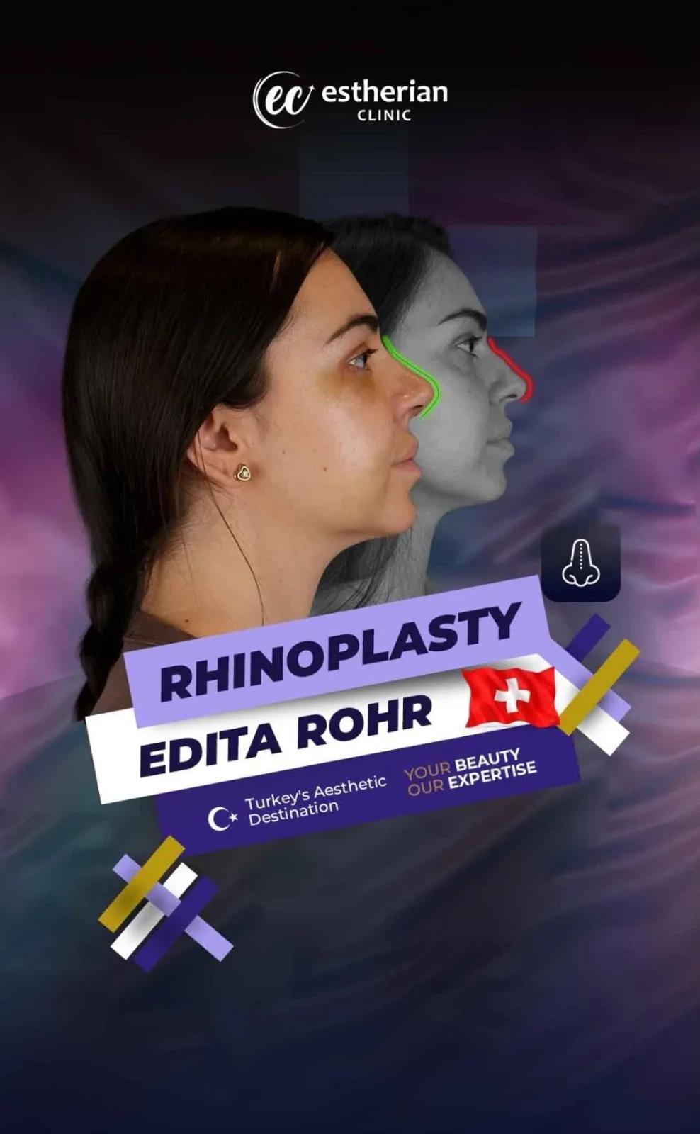 estherian Face Surgery 3