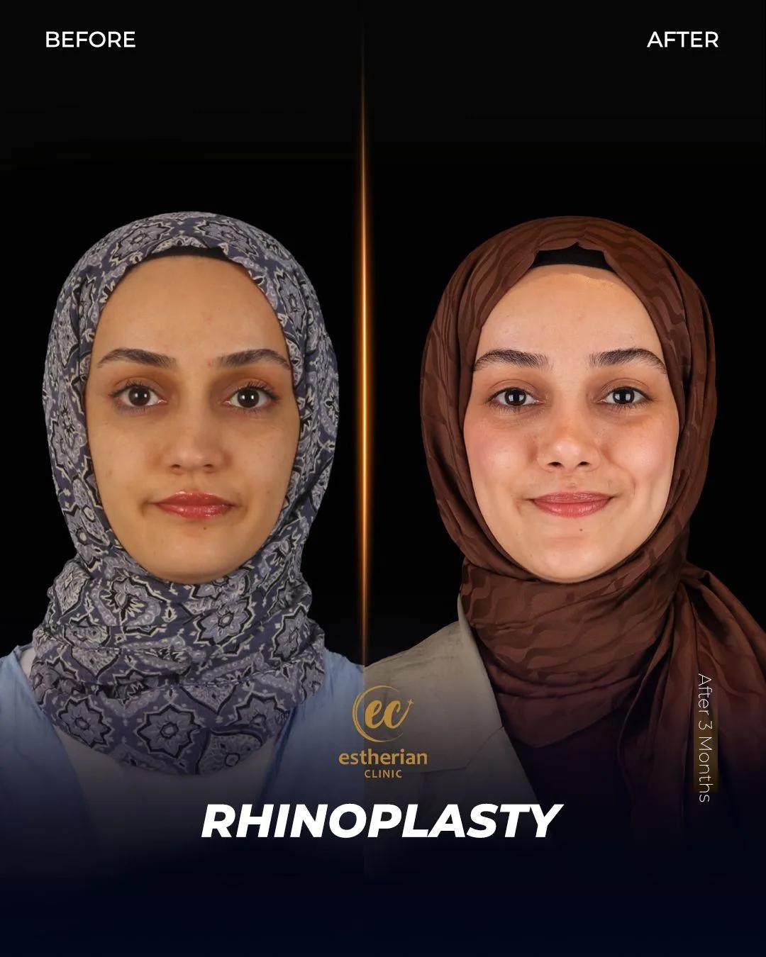 estherian Face Surgery 3