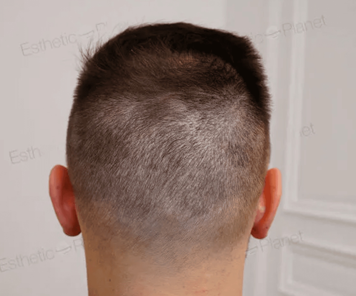 3800 FUE DR BEYHAN DONOR AREA