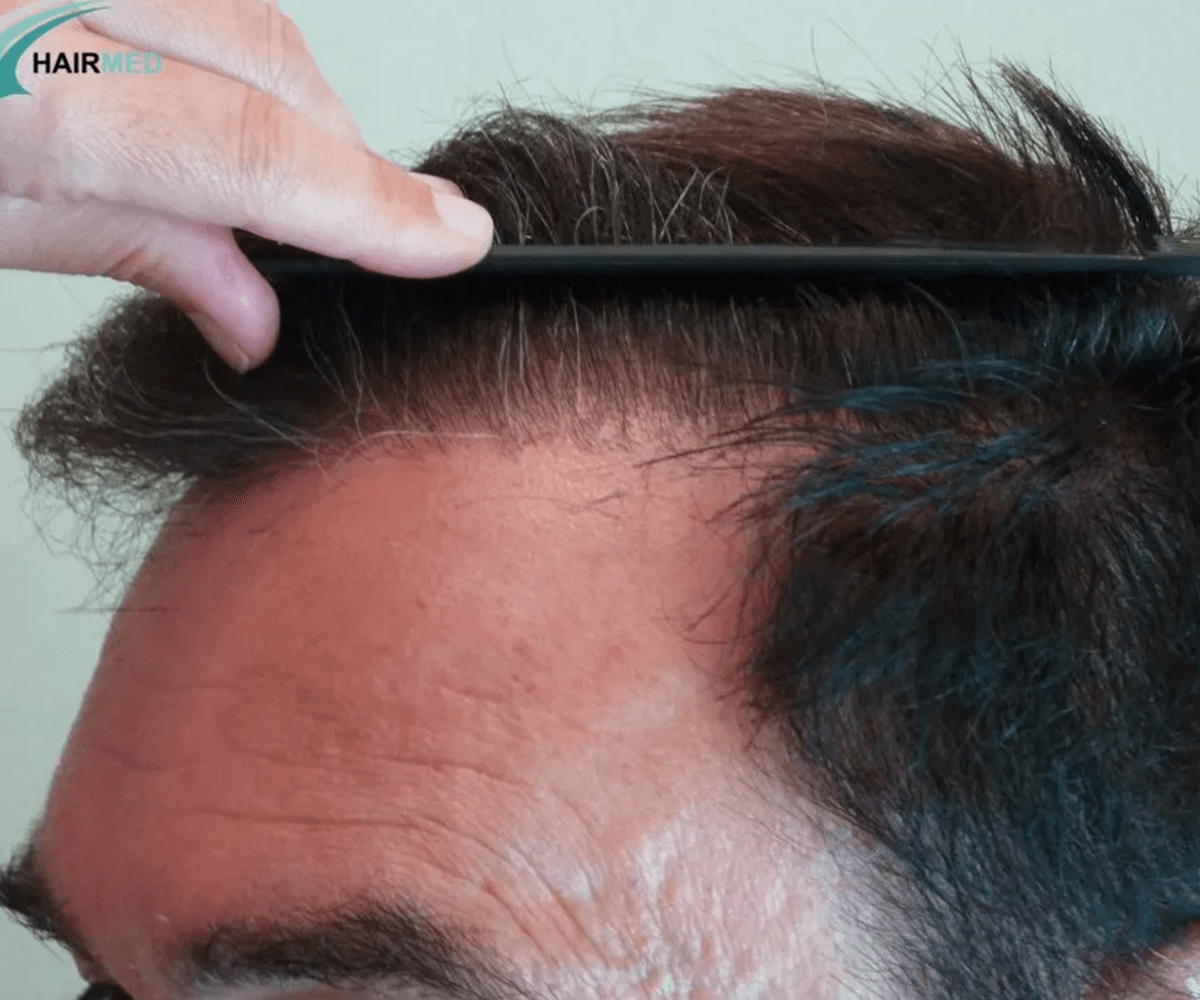 3800 FUE DR BEYHAN FRONT VIEW3