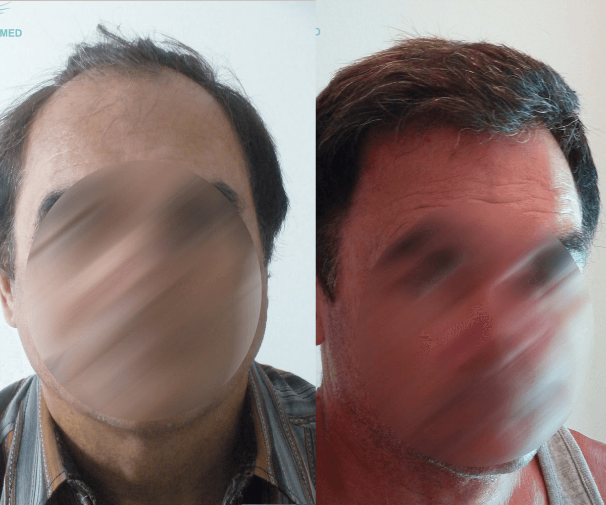 3800 FUE DR BEYHAN FRONT VIEW