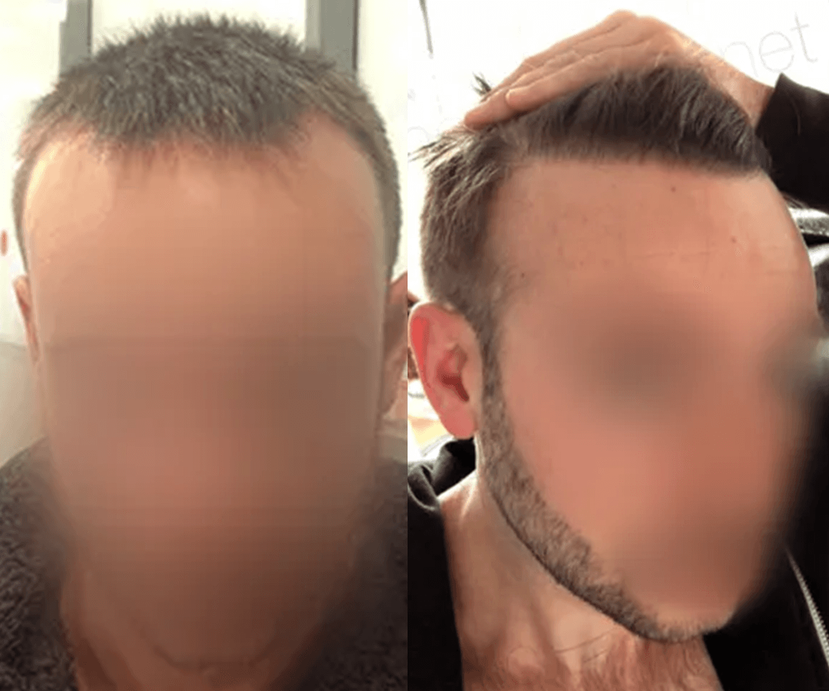 3000 FUE DR BEYHAN FRONT VIEW_