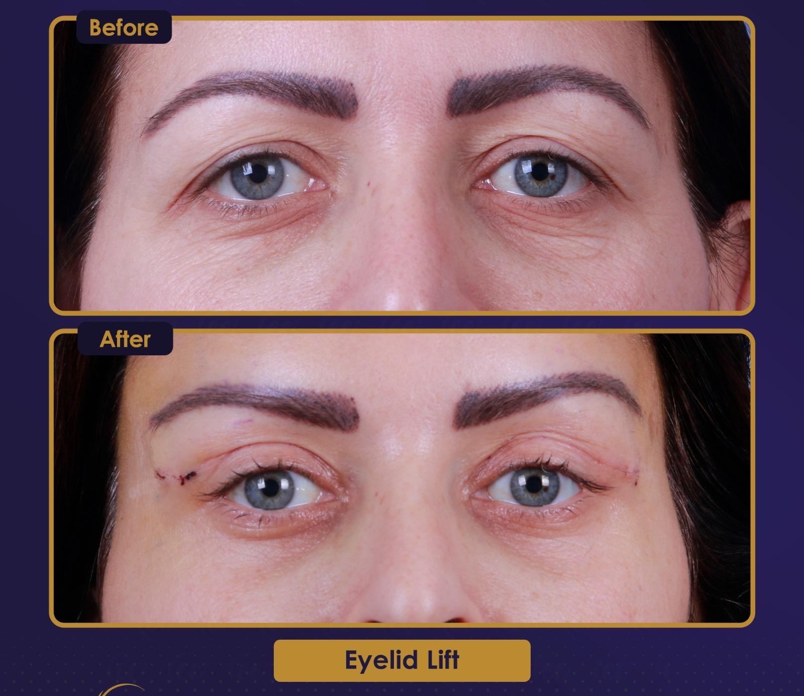 Résultat Estherian10