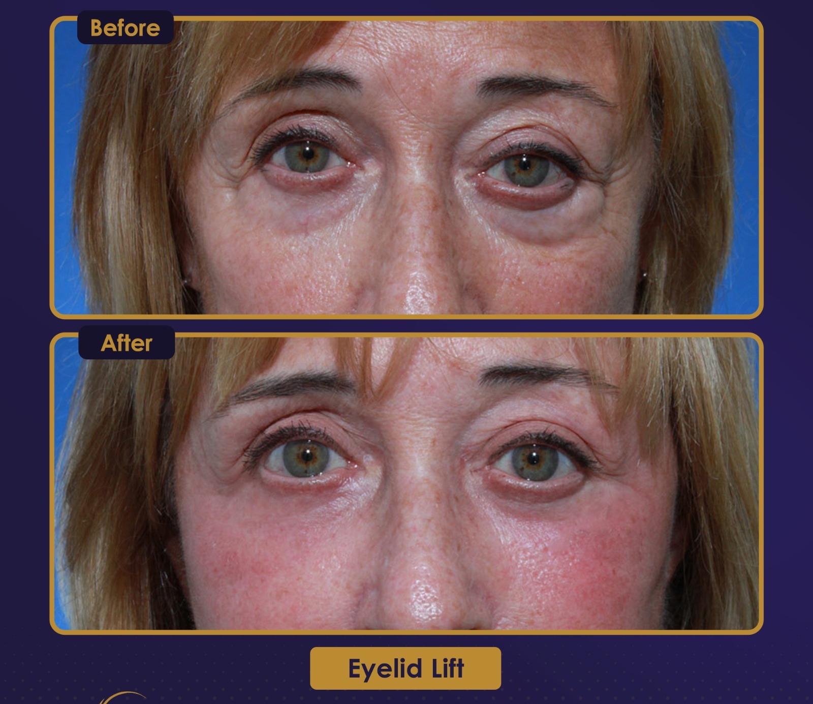 Résultat Estherian7