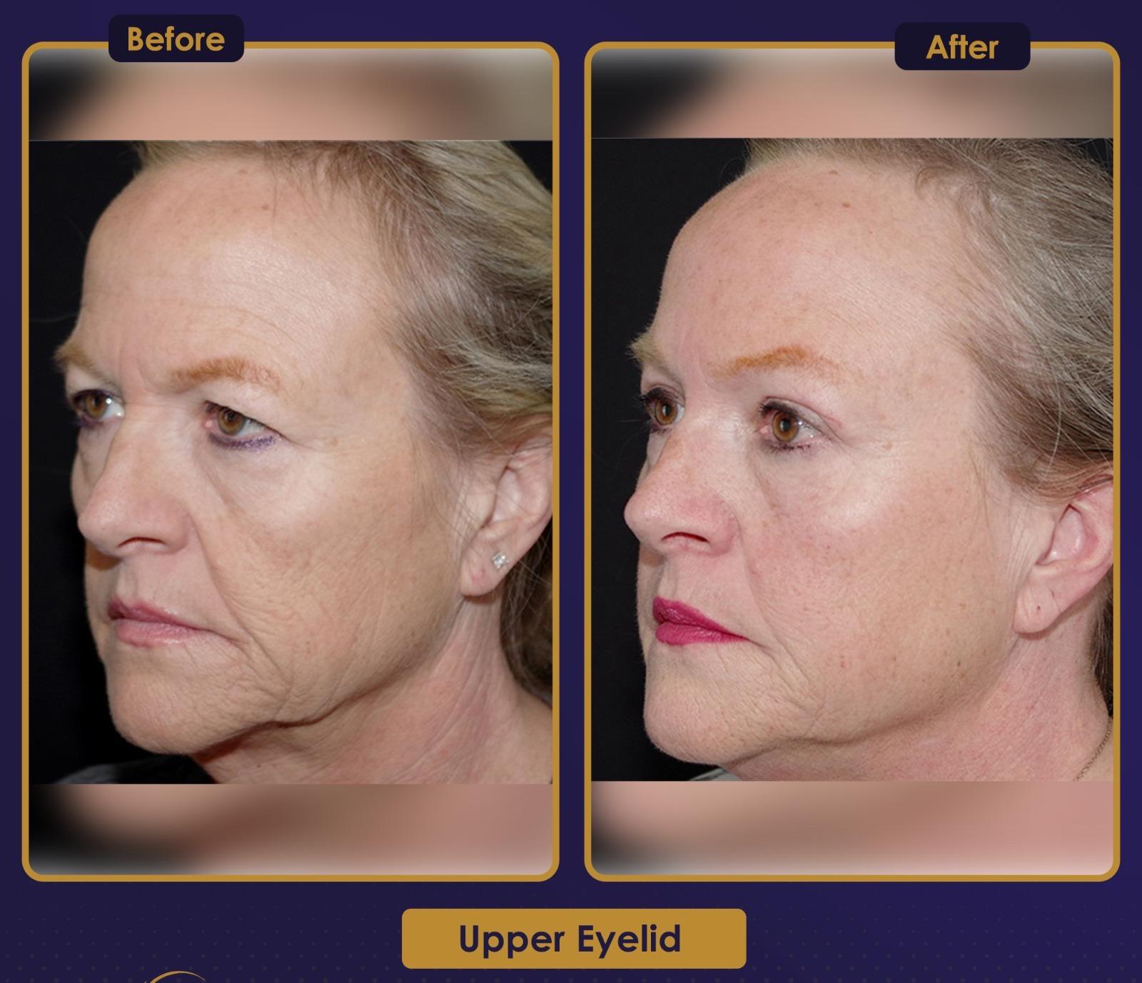 Résultat Estherian8