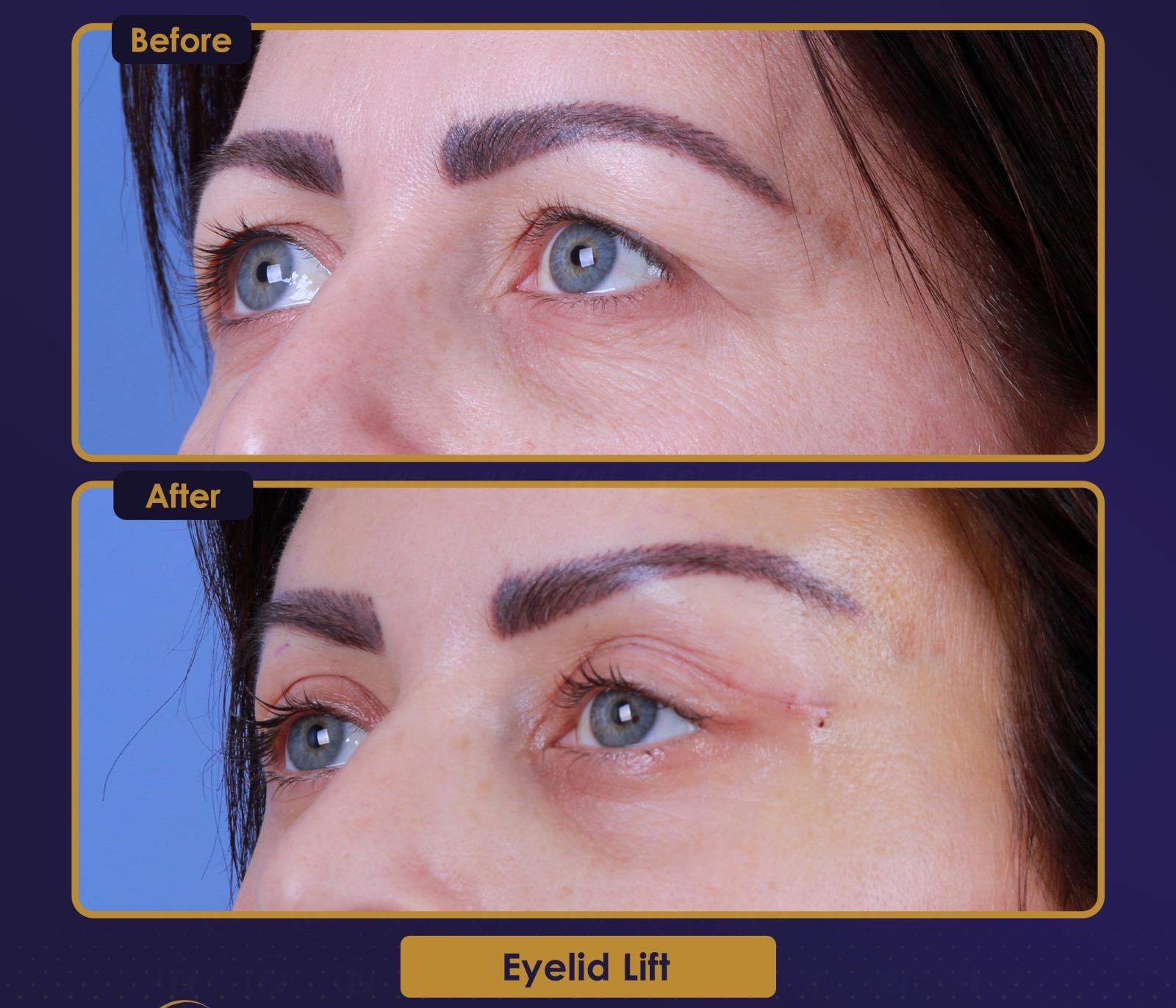 Résultat Estherian9