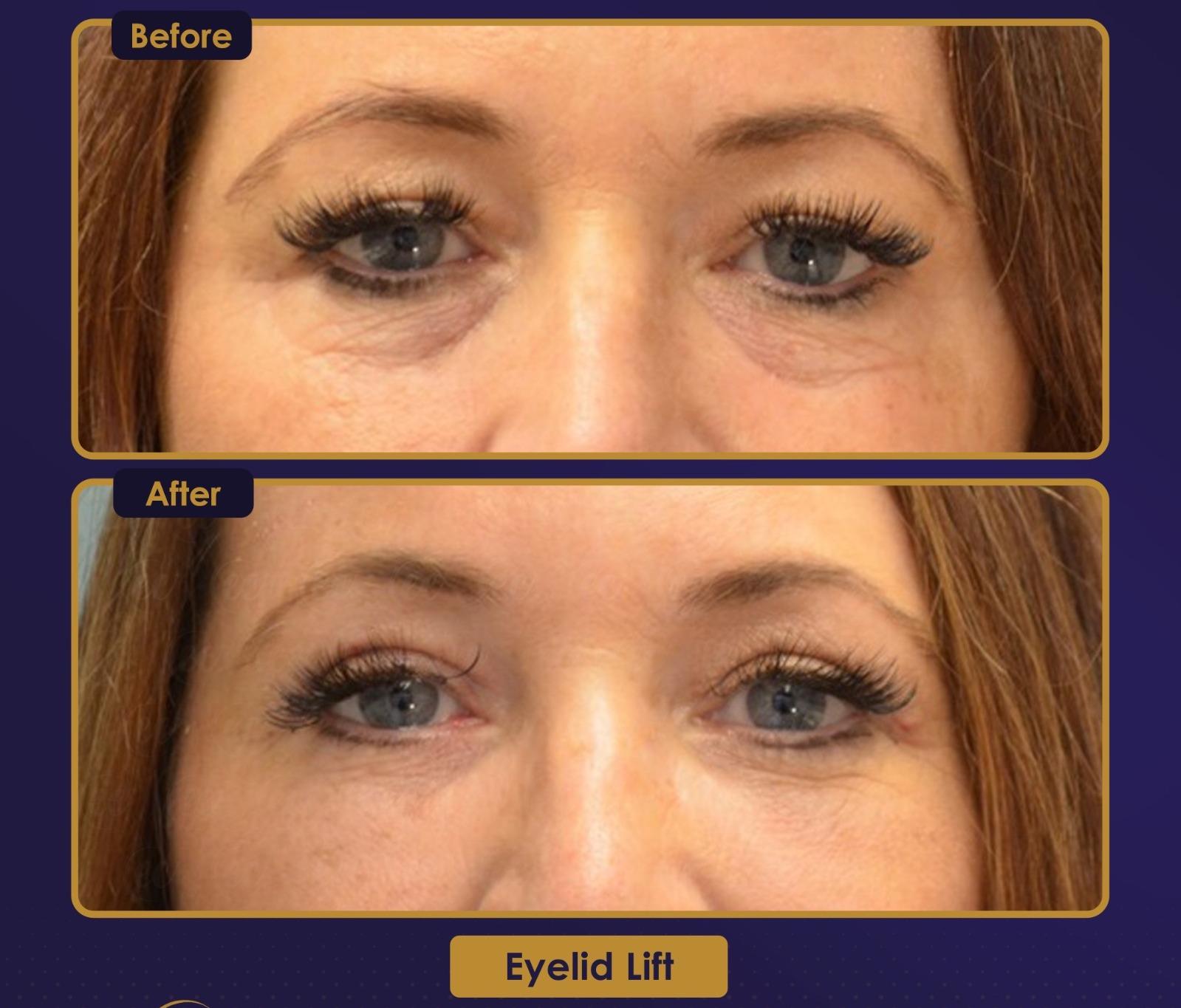 Résultat Estherian11