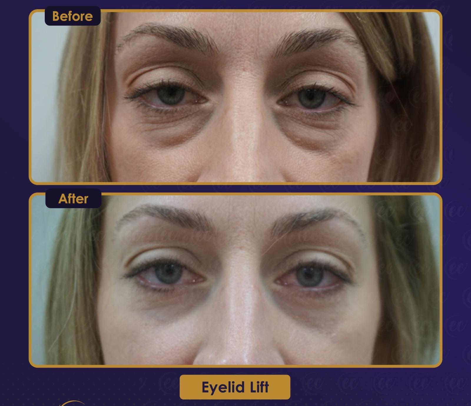 Résultat Estherian12