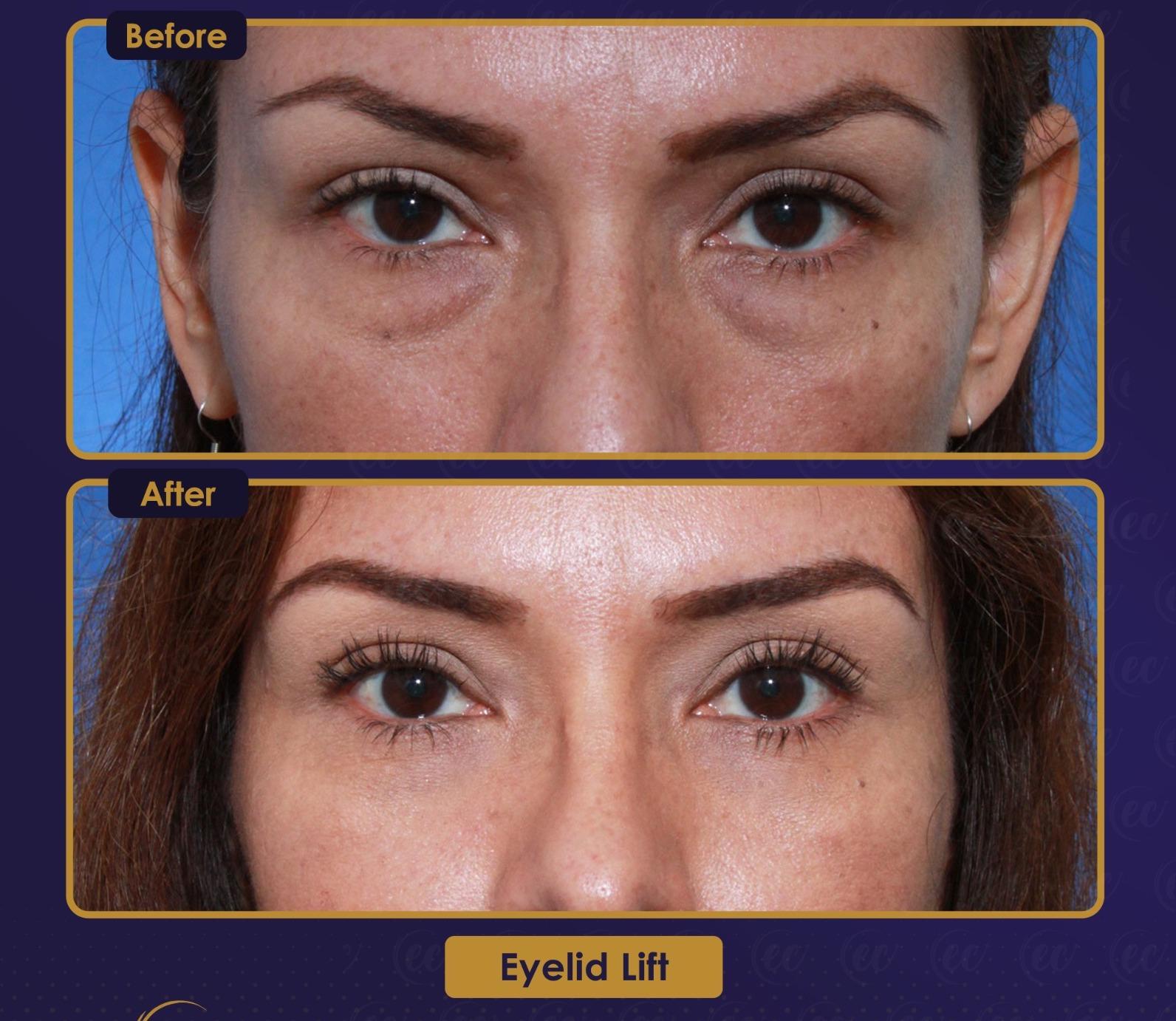 Résultat Estherian13