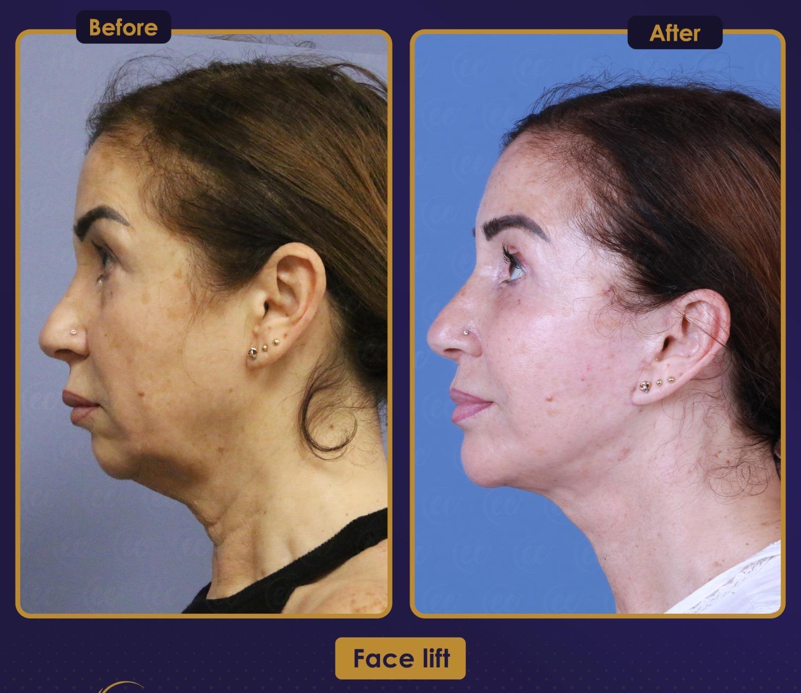 Résultat Estherian1